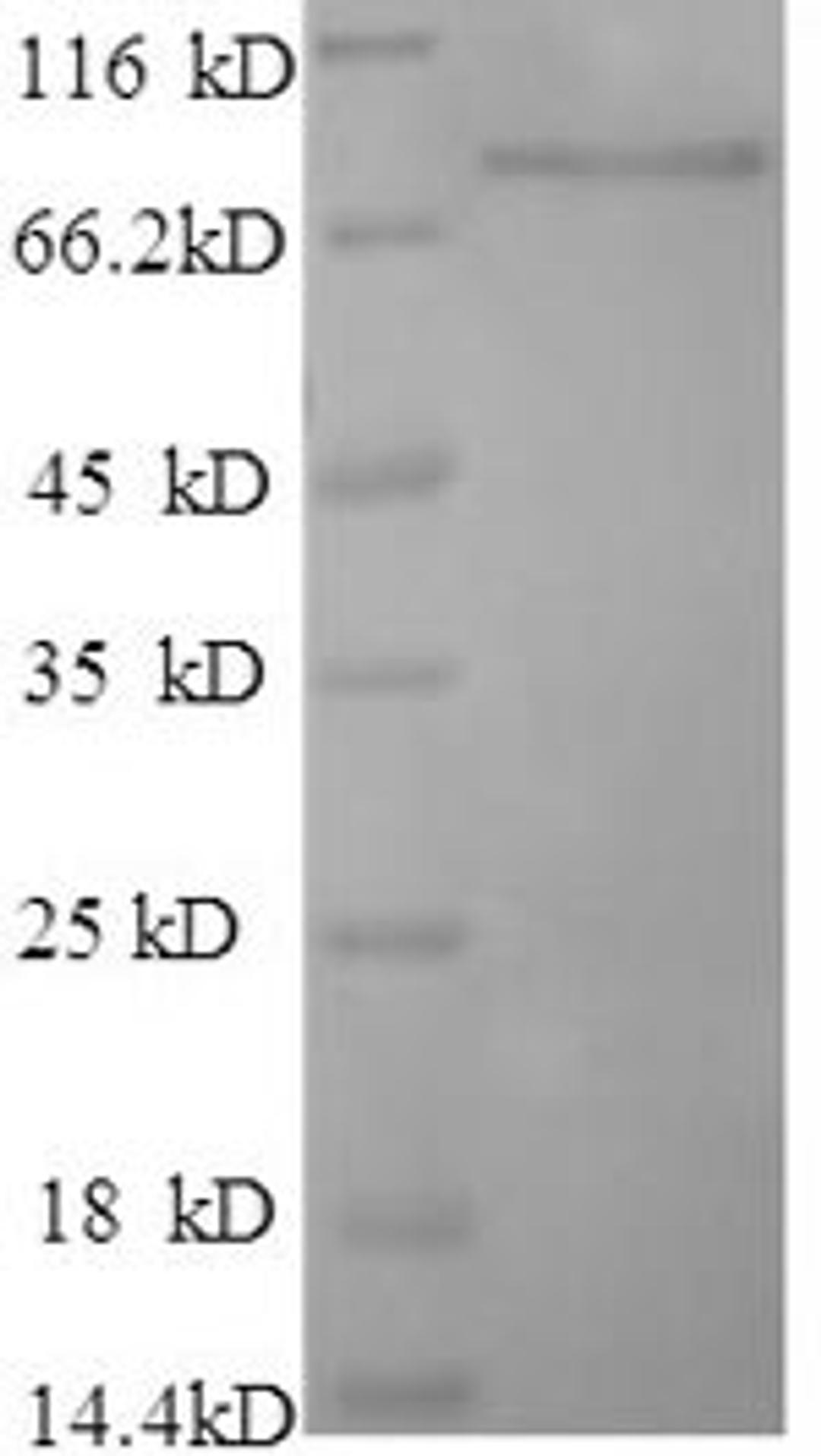 (Tris-Glycine gel) Discontinuous SDS-PAGE (reduced) with 5% enrichment gel and 15% separation gel.