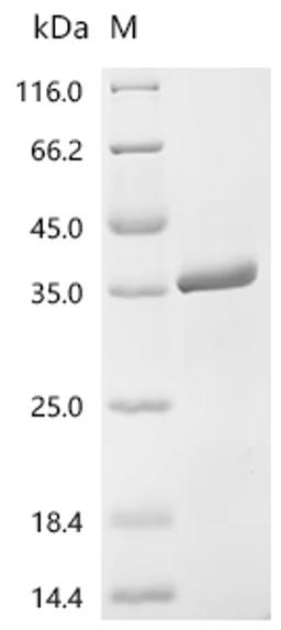(Tris-Glycine gel) Discontinuous SDS-PAGE (reduced) with 5% enrichment gel and 15% separation gel.