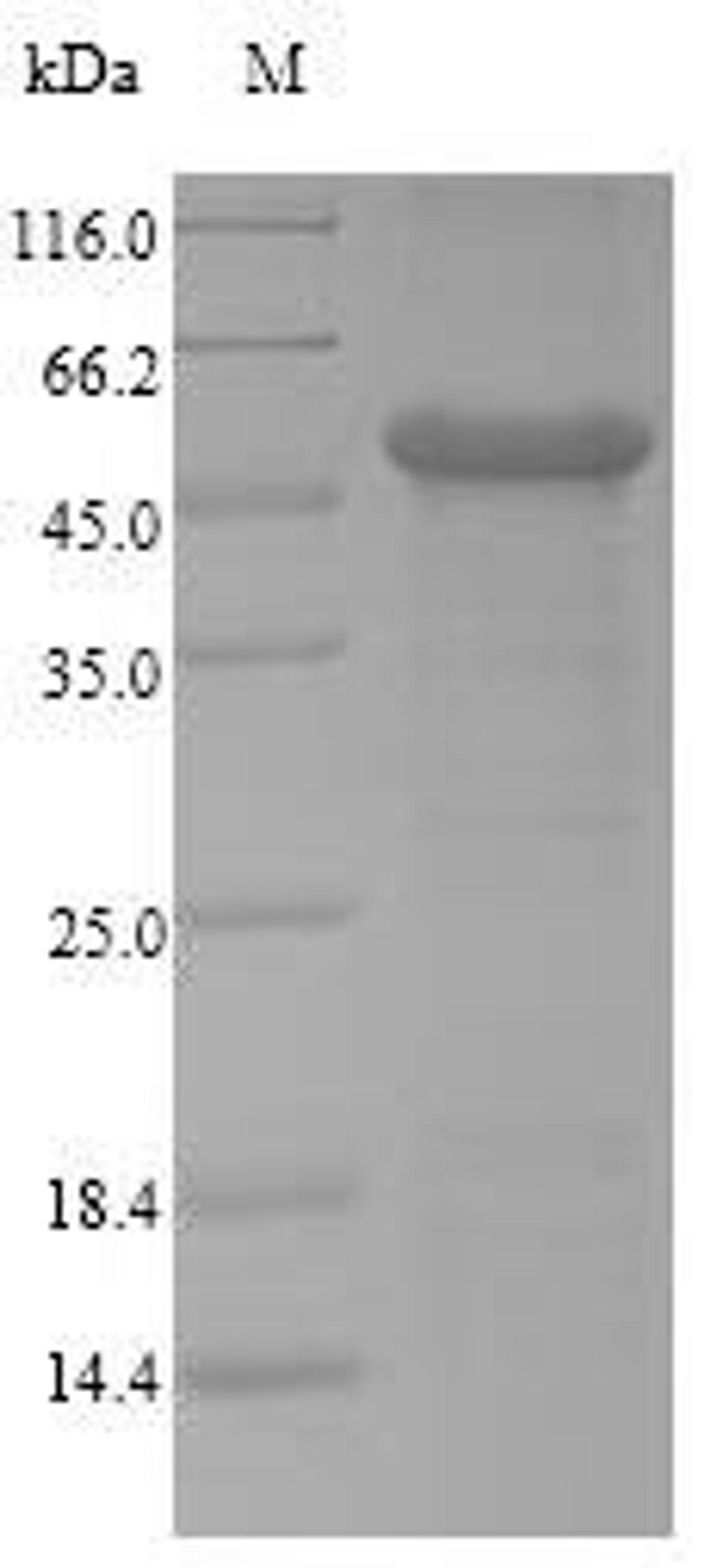 (Tris-Glycine gel) Discontinuous SDS-PAGE (reduced) with 5% enrichment gel and 15% separation gel.