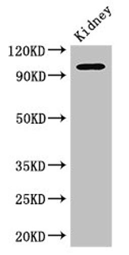 Western Blot. Positive WB detected in: Mouse kidney tissue. All lanes: AAK1 antibody at 2.5ug/ml. Secondary. Goat polyclonal to rabbit IgG at 1/50000 dilution. Predicted band size: 104, 94 kDa. Observed band size: 104 kDa. 