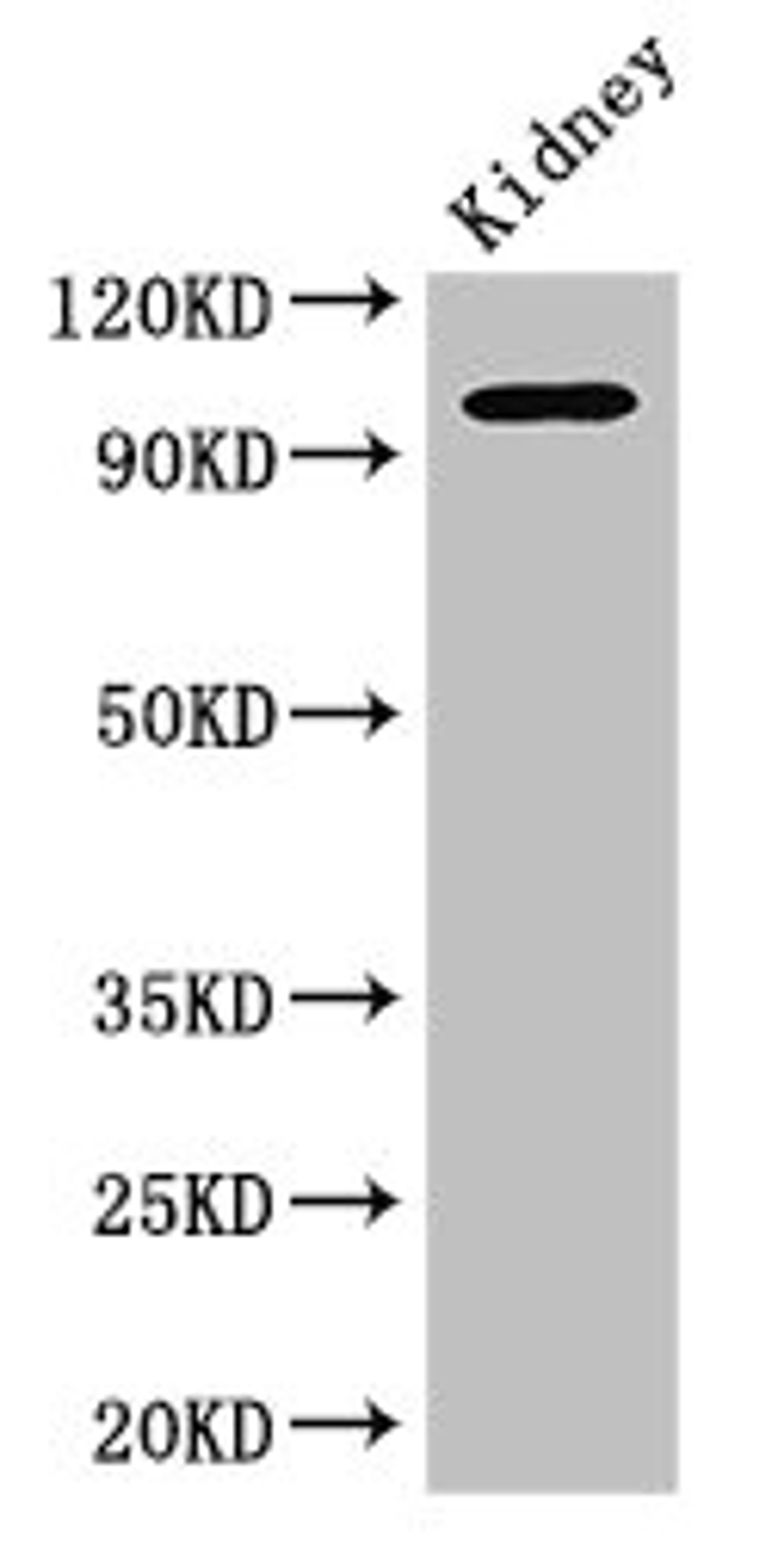 Western Blot. Positive WB detected in: Mouse kidney tissue. All lanes: AAK1 antibody at 2.5ug/ml. Secondary. Goat polyclonal to rabbit IgG at 1/50000 dilution. Predicted band size: 104, 94 kDa. Observed band size: 104 kDa. 