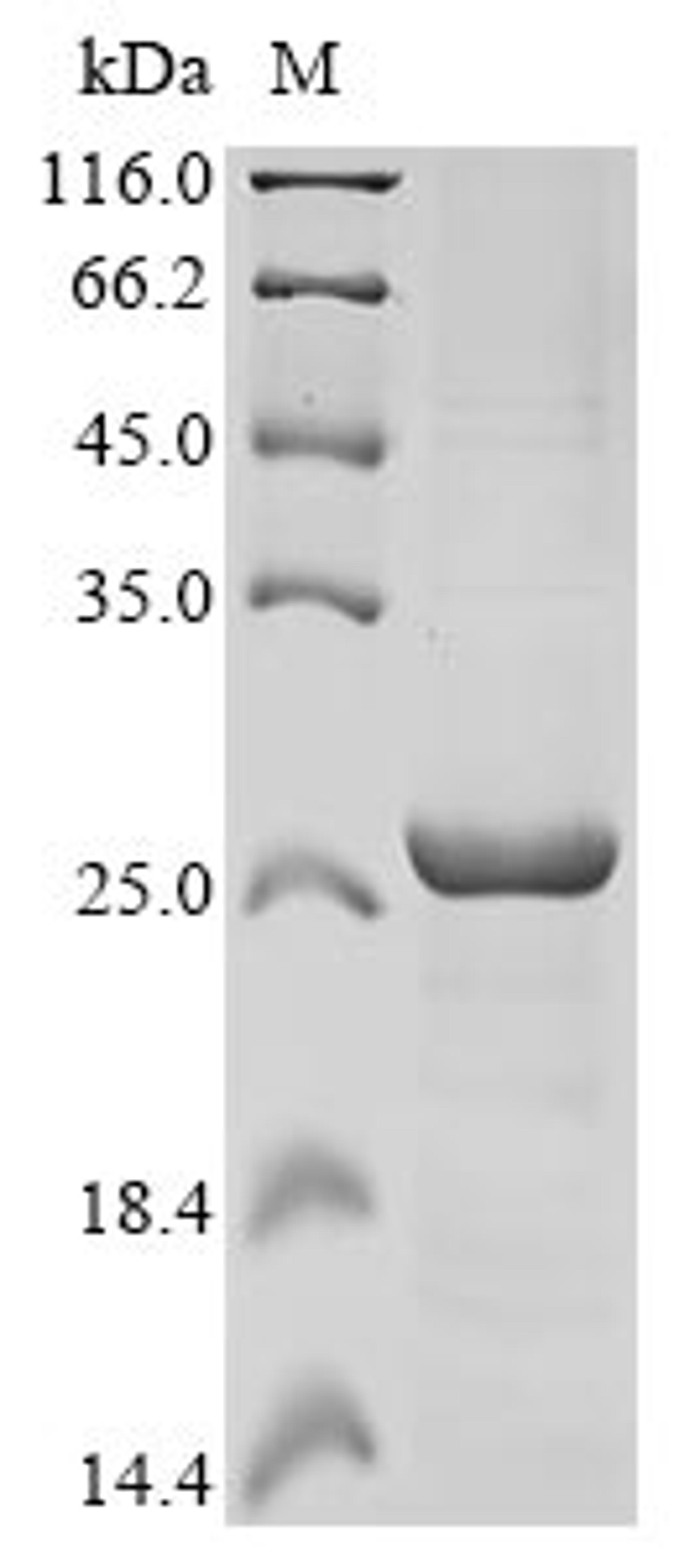 (Tris-Glycine gel) Discontinuous SDS-PAGE (reduced) with 5% enrichment gel and 15% separation gel.