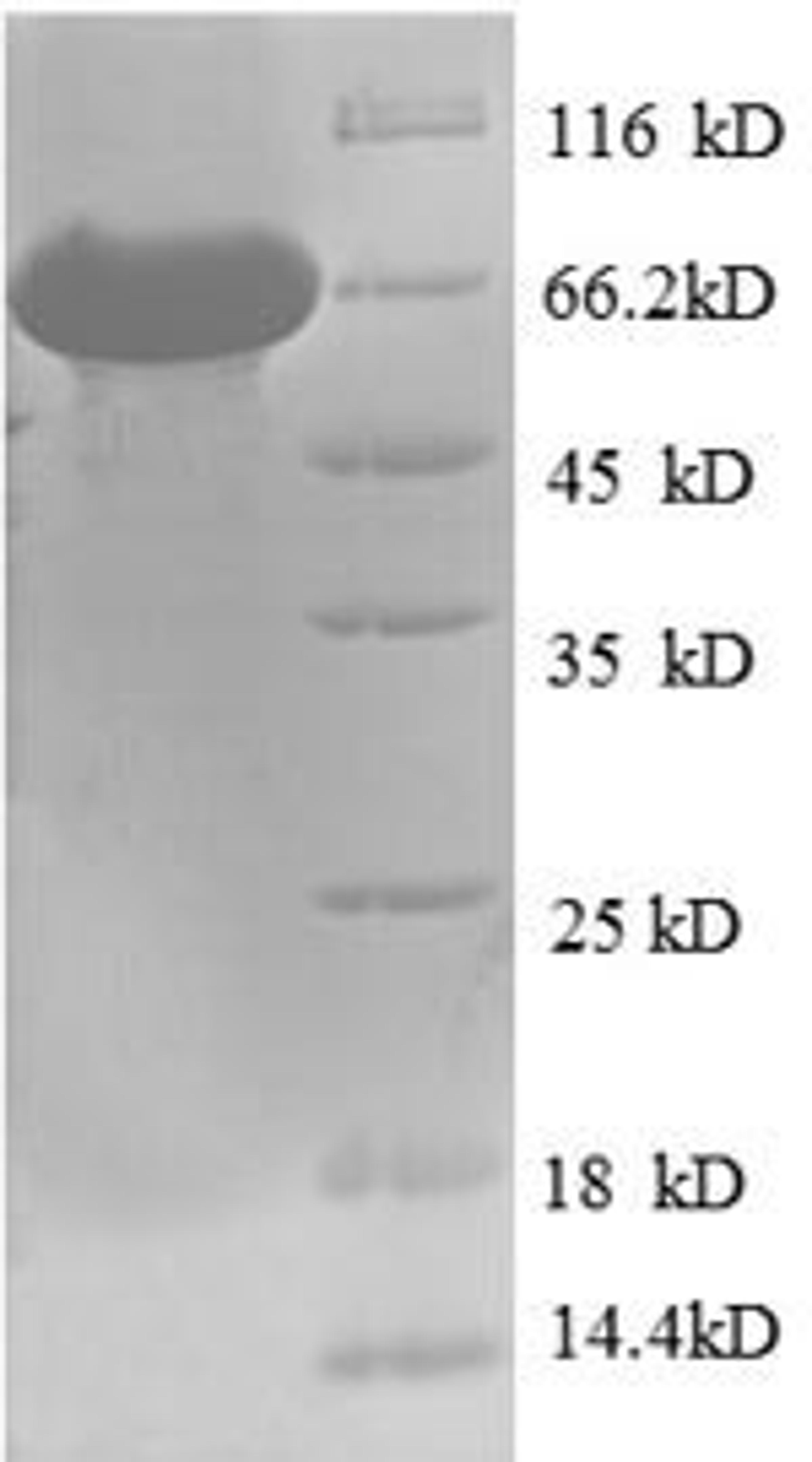 (Tris-Glycine gel) Discontinuous SDS-PAGE (reduced) with 5% enrichment gel and 15% separation gel.
