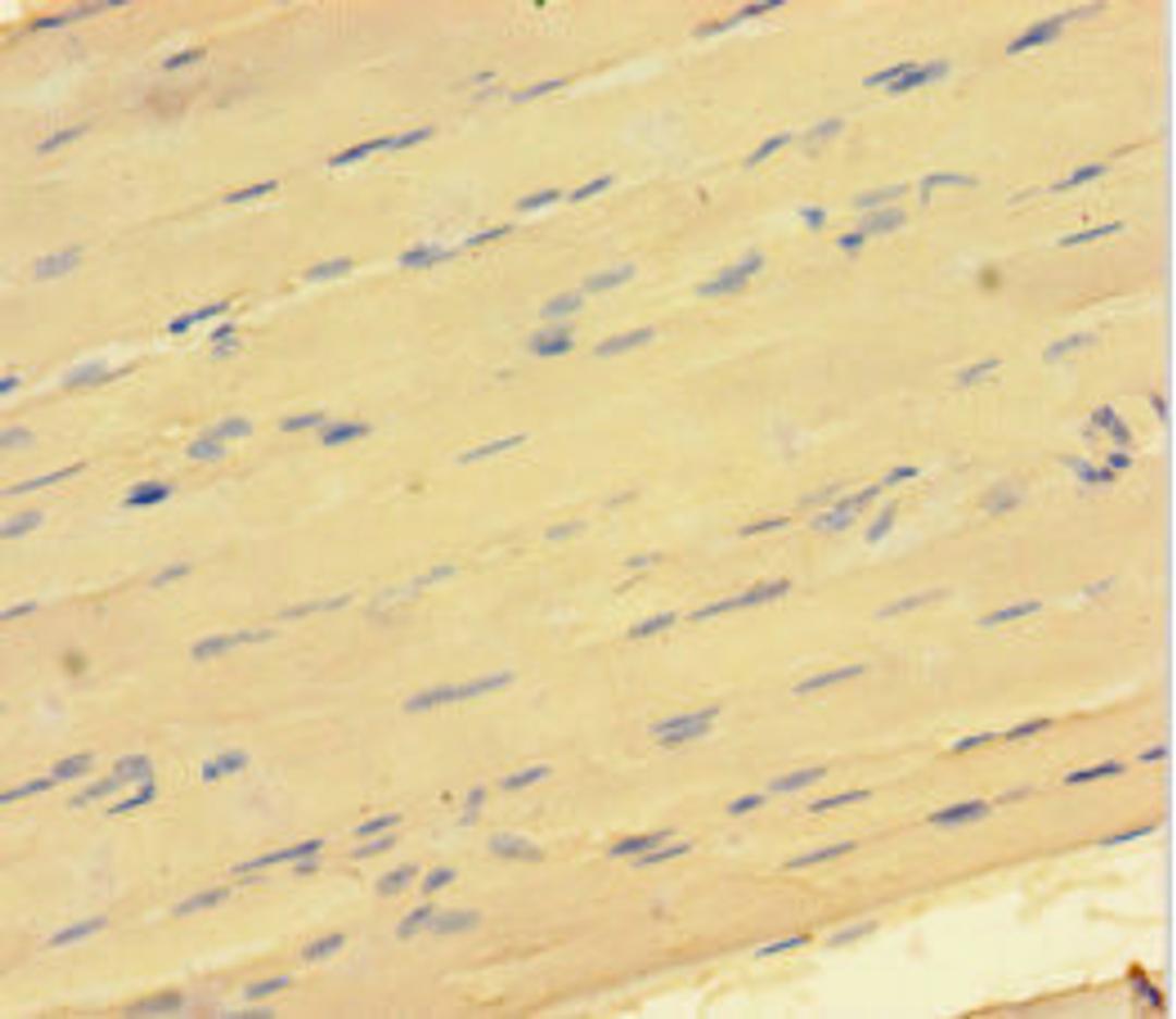 Immunohistochemistry of paraffin-embedded human skeletal muscle tissue using CSB-PA883616HA01HU at dilution of 1:100