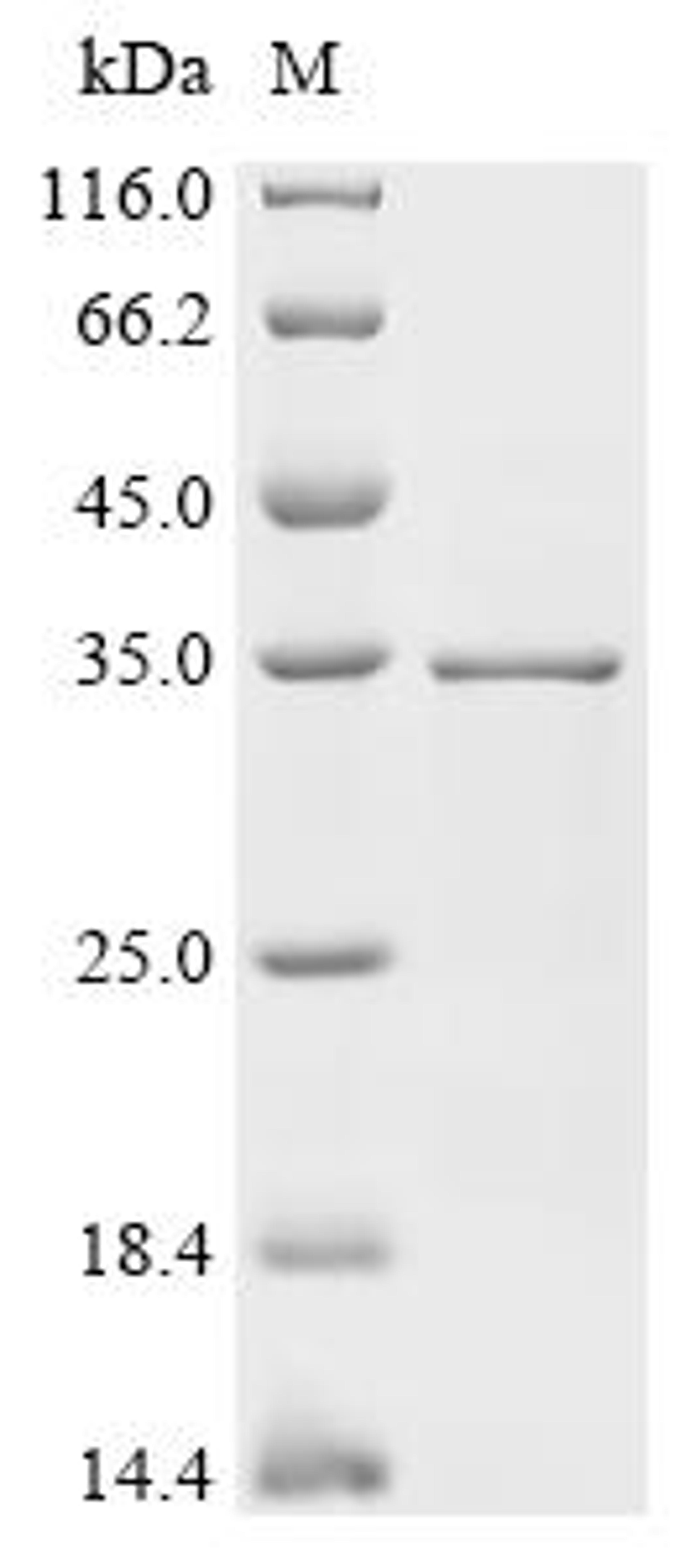 (Tris-Glycine gel) Discontinuous SDS-PAGE (reduced) with 5% enrichment gel and 15% separation gel.