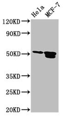 Western Blot. Positive WB detected in: Hela whole cell lysate, MCF-7 whole cell lysate. All lanes: TFAP2B antibody at 3.2µg/ml. Secondary. Goat polyclonal to rabbit IgG at 1/50000 dilution. Predicted band size: 51, 52 kDa. Observed band size: 51, 52 kDa