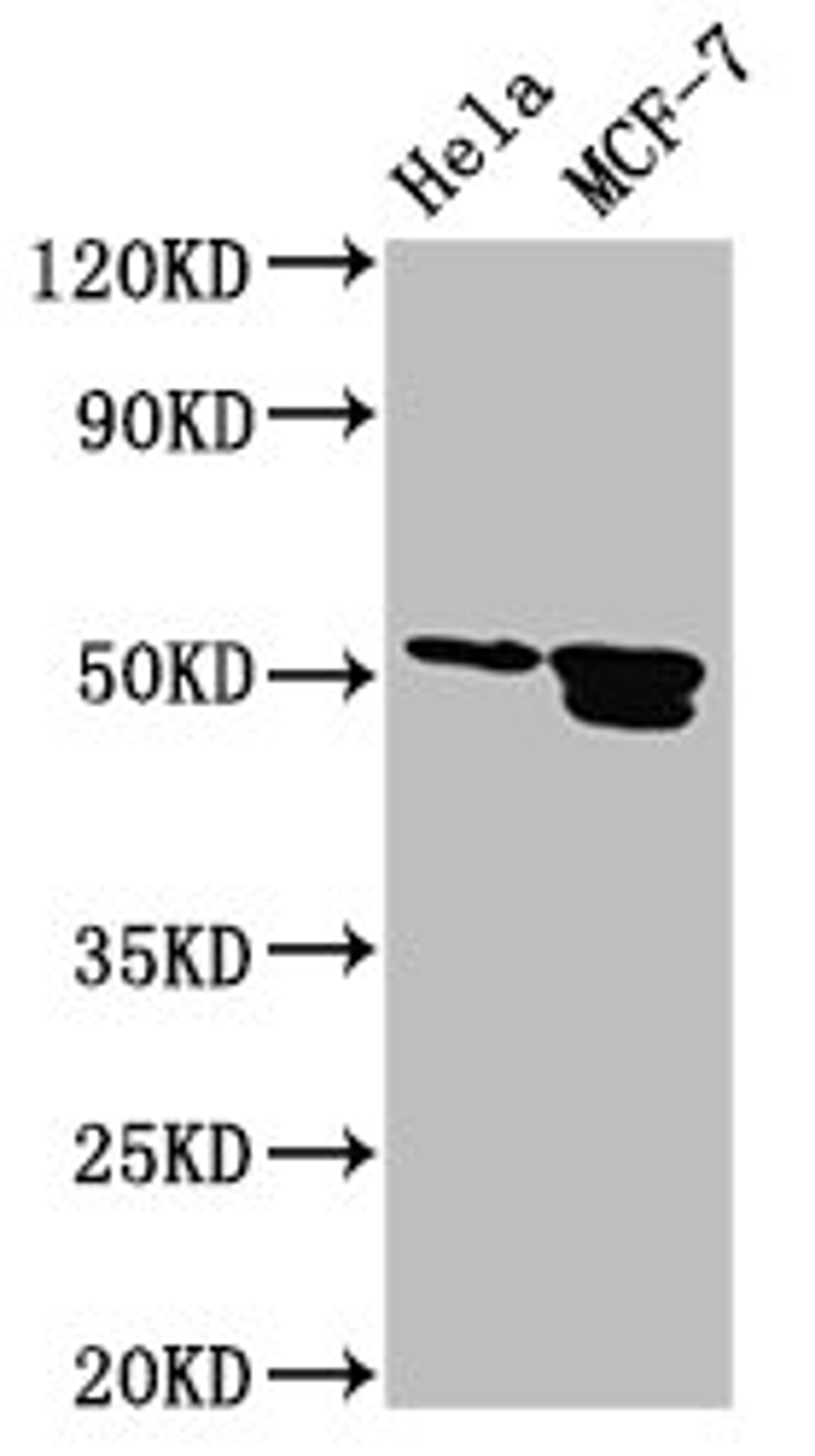 Western Blot. Positive WB detected in: Hela whole cell lysate, MCF-7 whole cell lysate. All lanes: TFAP2B antibody at 3.2µg/ml. Secondary. Goat polyclonal to rabbit IgG at 1/50000 dilution. Predicted band size: 51, 52 kDa. Observed band size: 51, 52 kDa