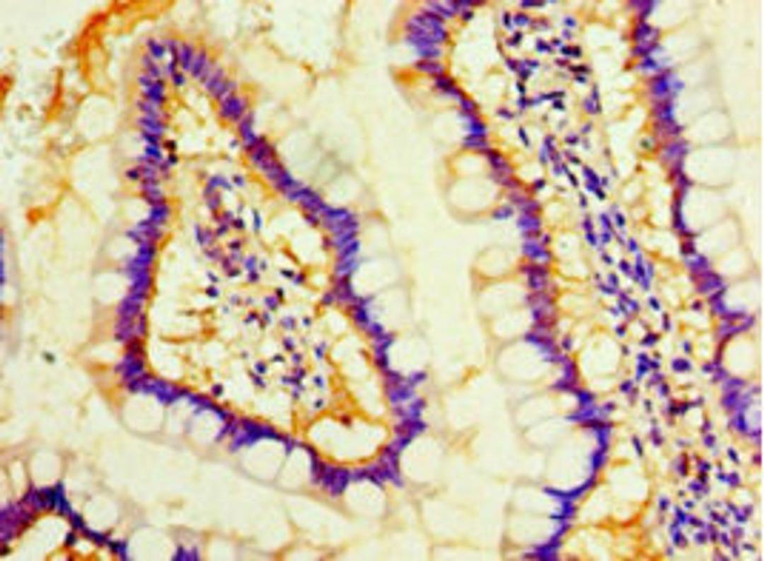 Immunohistochemistry of paraffin-embedded human small intestine tissue using CSB-PA872519HA01HU at dilution of 1:100