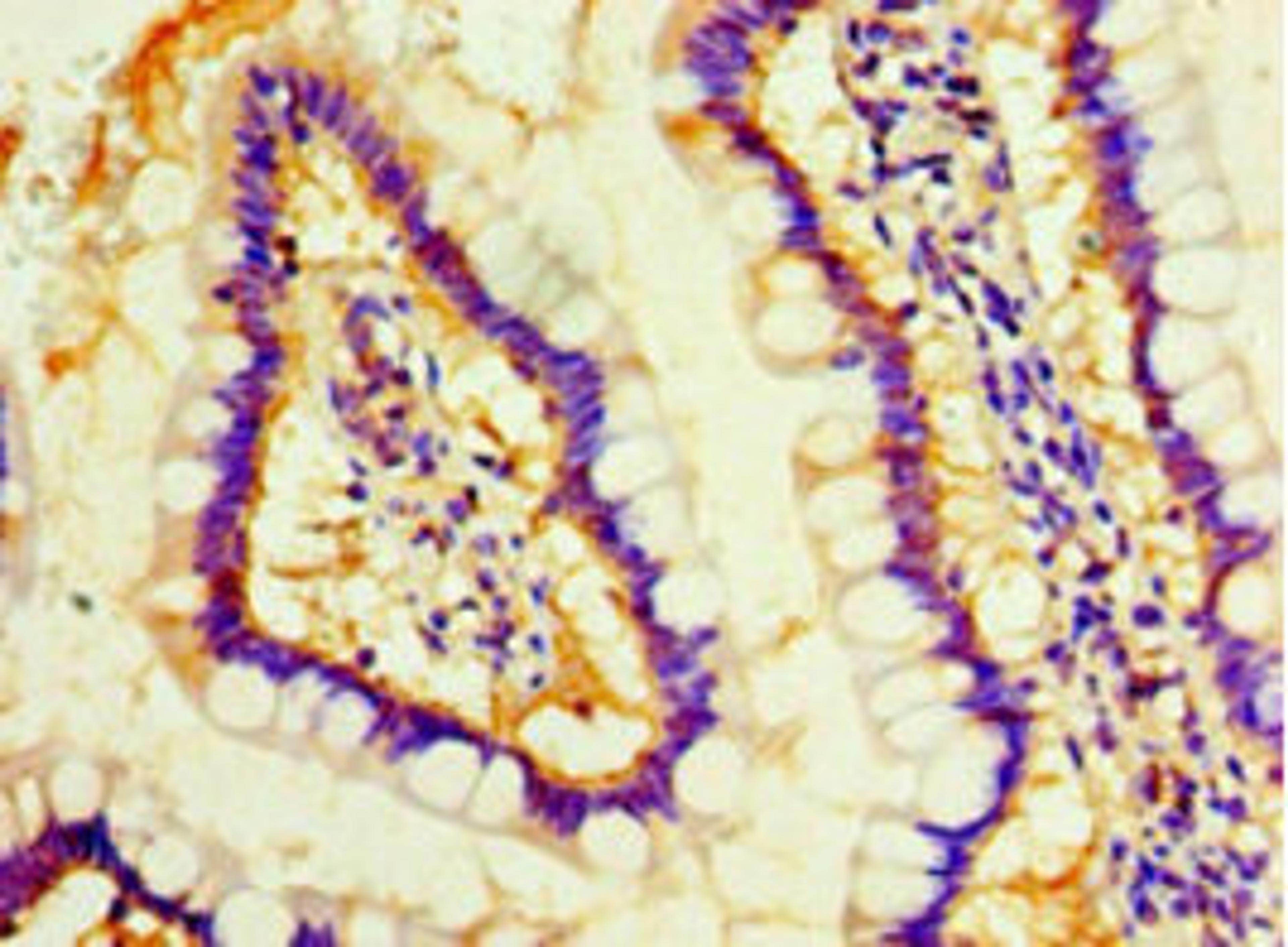 Immunohistochemistry of paraffin-embedded human small intestine tissue using CSB-PA872519HA01HU at dilution of 1:100