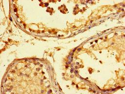 Immunohistochemistry of paraffin-embedded human testis tissue using CSB-PA770344LA01HU at dilution of 1:100