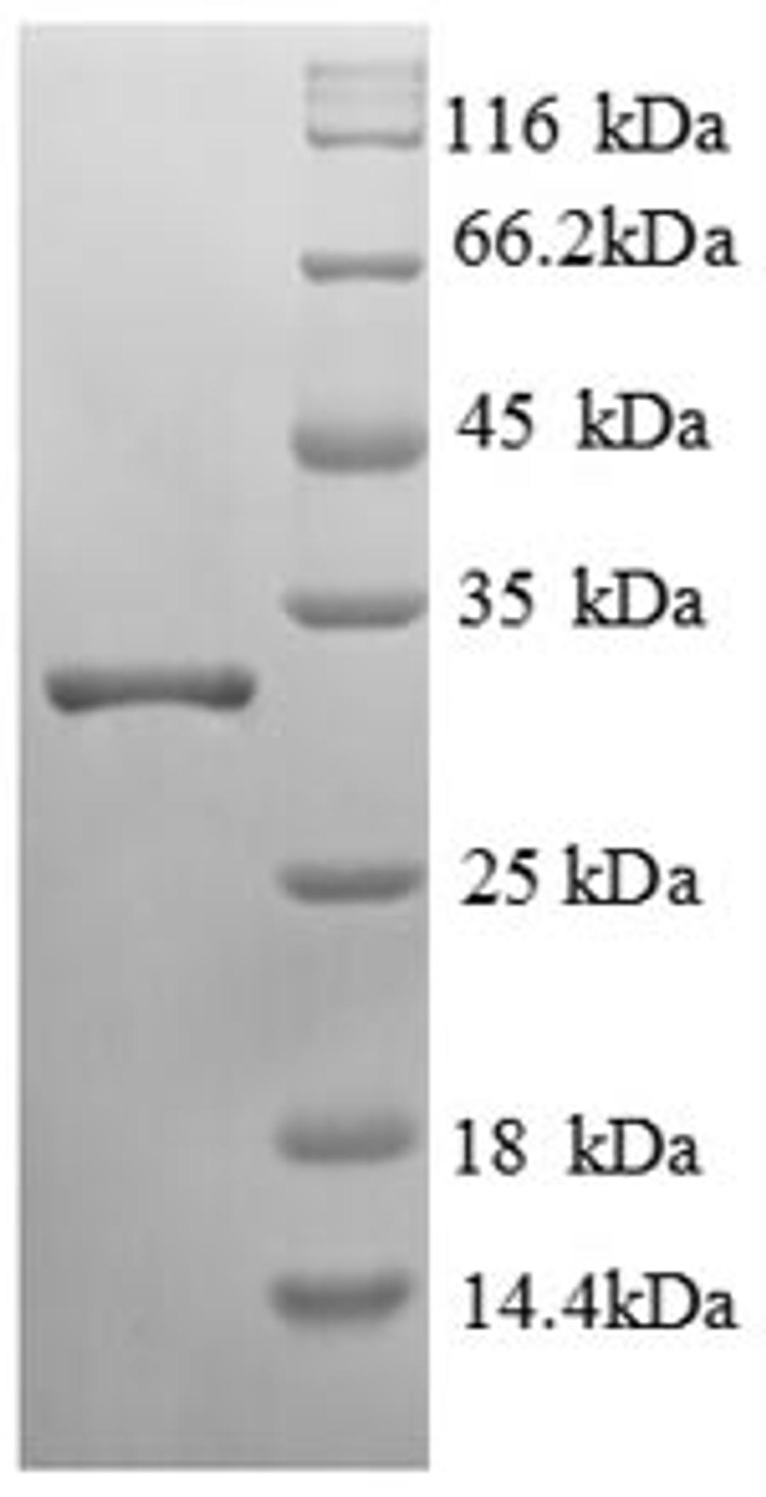 (Tris-Glycine gel) Discontinuous SDS-PAGE (reduced) with 5% enrichment gel and 15% separation gel.