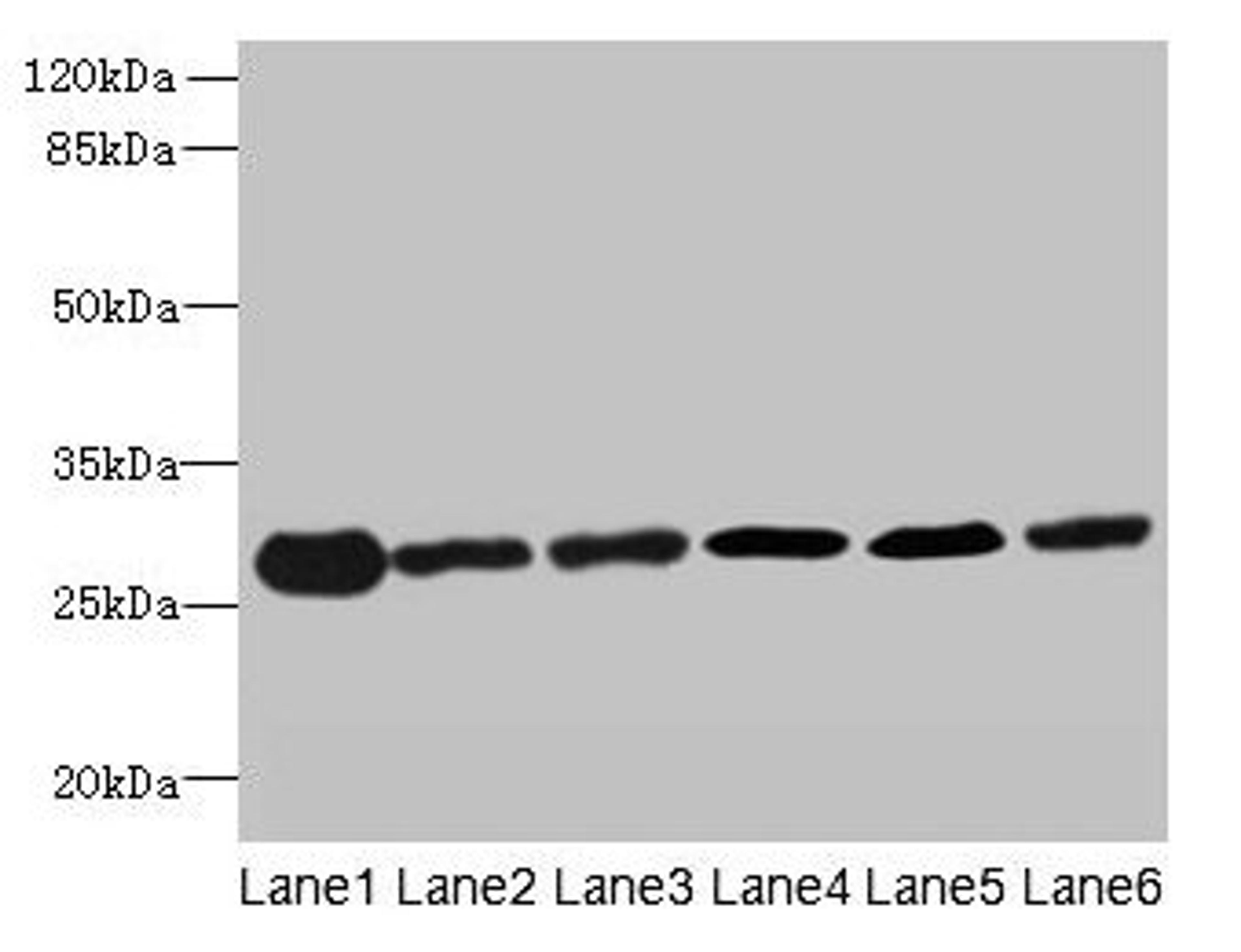Western blot. All lanes: TMED9 antibody at 4.5µg/ml. Lane 1: Mouse liver tissue. Lane 2: Mouse kidney tissue. Lane 3: Human placenta tissue. Lane 4: A549 whole cell lysate. Lane 5: MCF-7 whole cell lysate. Lane 6: A431 whole cell lysate. Secondary. Goat polyclonal to rabbit IgG at 1/10000 dilution. Predicted band size: 28 kDa. Observed band size: 28 kDa