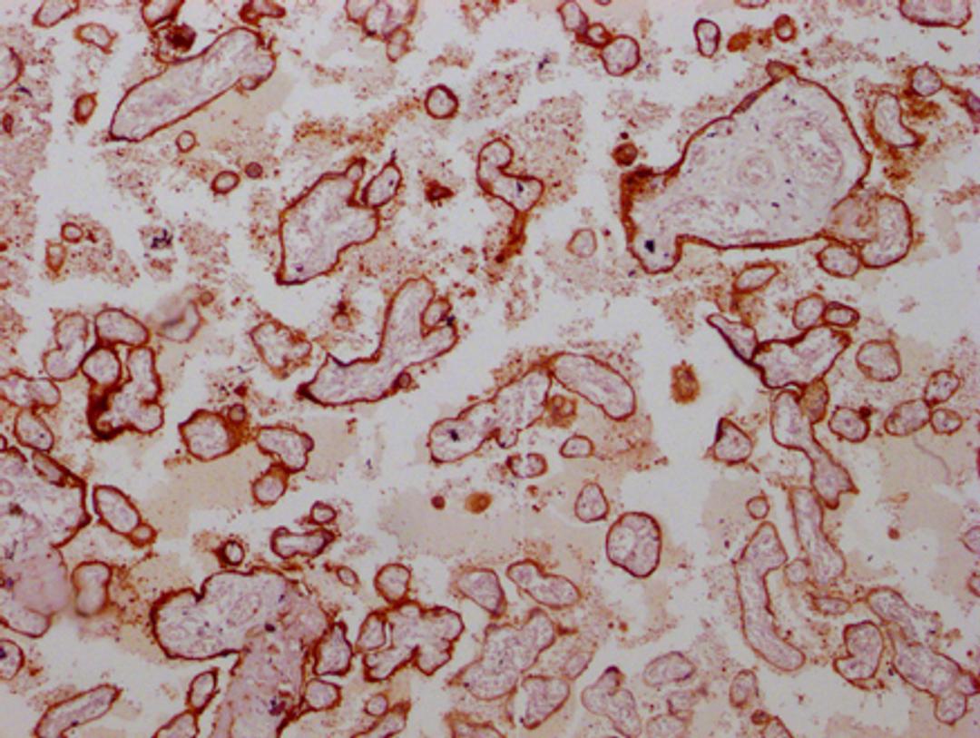 IHC image of CSB-MA219783 diluted at 1:100 and staining in paraffin-embedded human placenta tissue performed on a Leica BondTM system. After dewaxing and hydration, antigen retrieval was mediated by high pressure in a citrate buffer (pH 6.0). Section was blocked with 10% normal goat serum 30min at RT. Then primary antibody (1% BSA) was incubated at 4°C overnight. The primary is detected by a Goat anti-mouse IgG polymer labeled by HRP and visualized using 0.05% DAB.