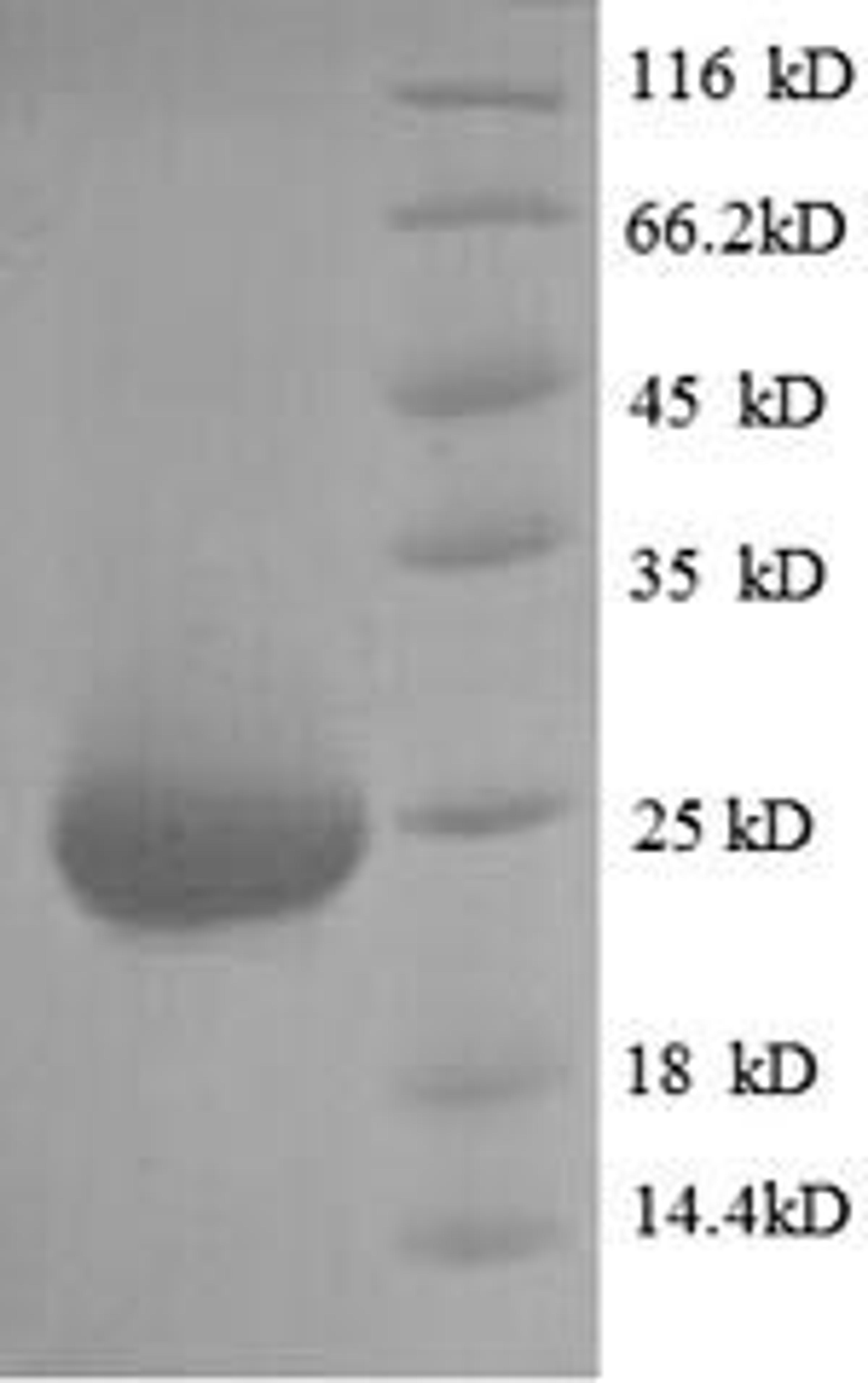 (Tris-Glycine gel) Discontinuous SDS-PAGE (reduced) with 5% enrichment gel and 15% separation gel.