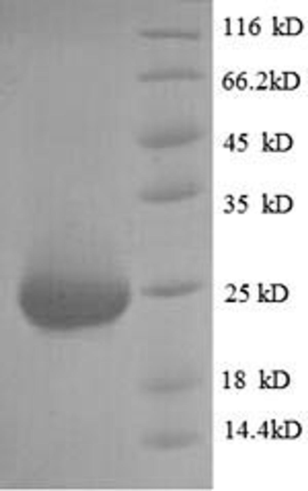 (Tris-Glycine gel) Discontinuous SDS-PAGE (reduced) with 5% enrichment gel and 15% separation gel.