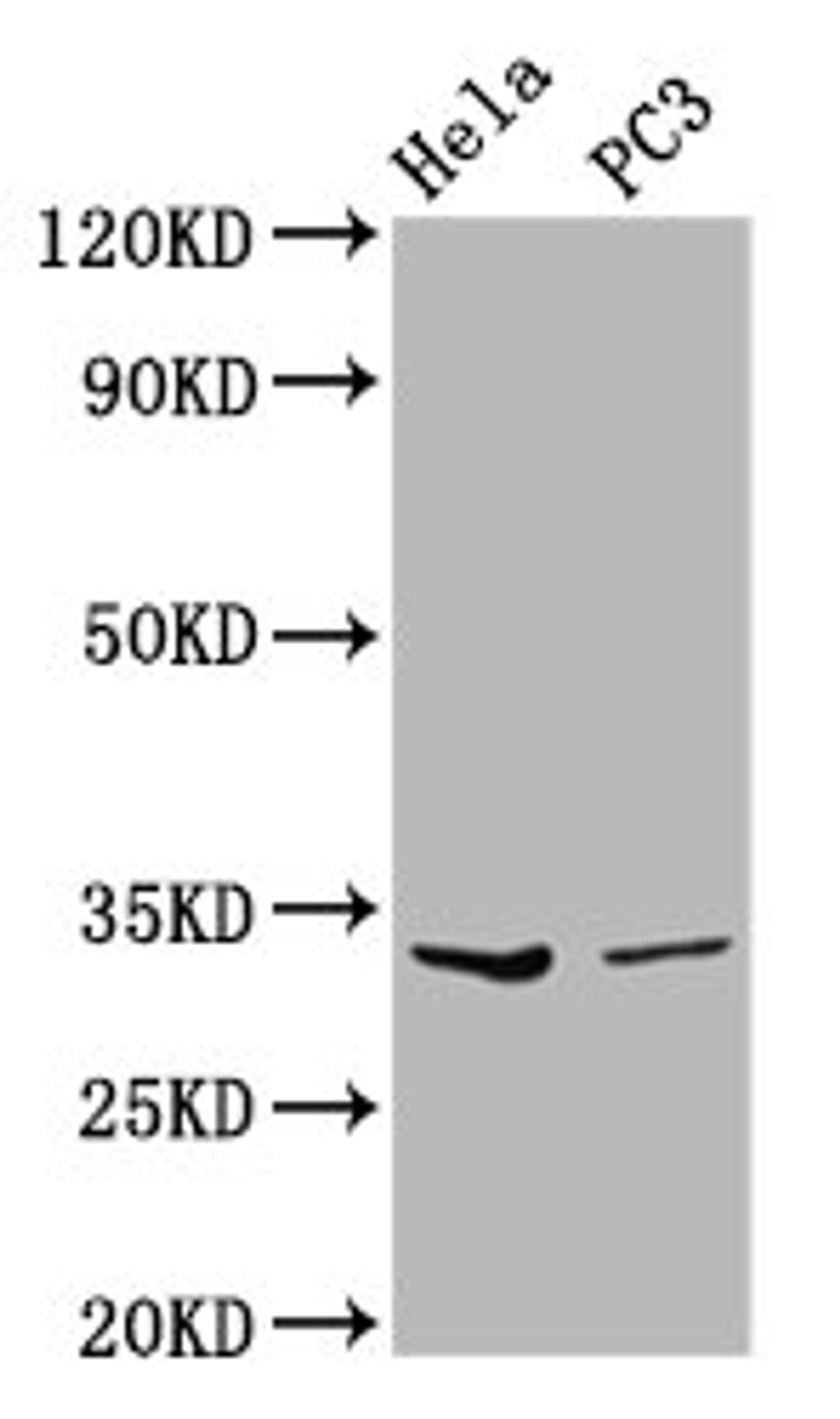Western Blot. Positive WB detected in: Hela whole cell lysate, PC-3 whole cell lysate. All lanes: RNASEH1 antibody at 3.59µg/ml. Secondary. Goat polyclonal to rabbit IgG at 1/50000 dilution. Predicted band size: 33 kDa. Observed band size: 33 kDa