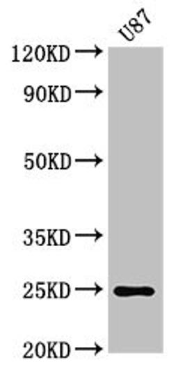 Western Blot. Positive WB detected in: U87 whole cell lysate. All lanes: RGS2 antibody at 3µg/ml. Secondary. Goat polyclonal to rabbit IgG at 1/50000 dilution. Predicted band size: 25, 24, 23, 21 kDa. Observed band size: 25 kDa