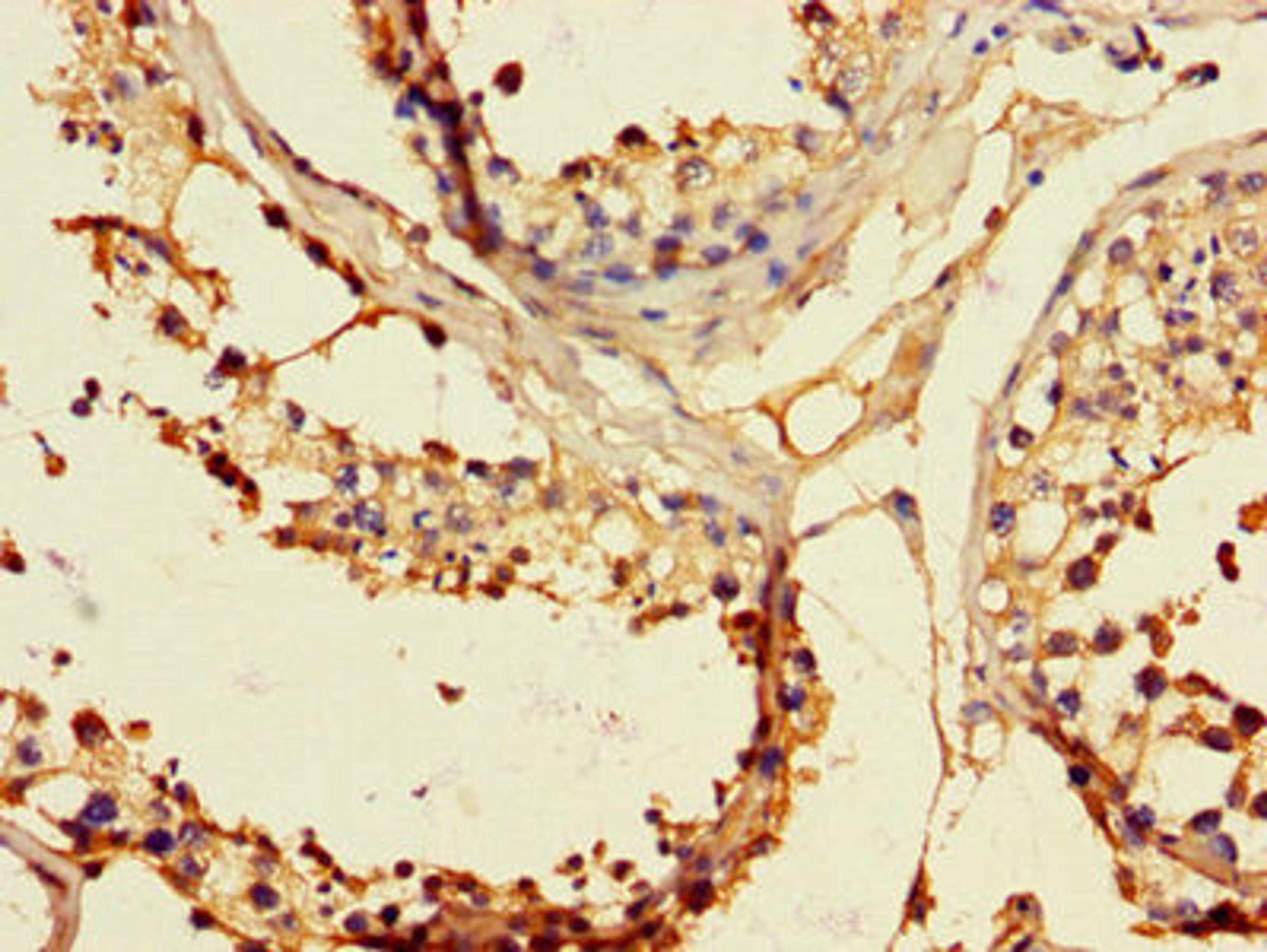 Immunohistochemistry of paraffin-embedded human testis tissue using CSB-PA007730LA01HU at dilution of 1:100