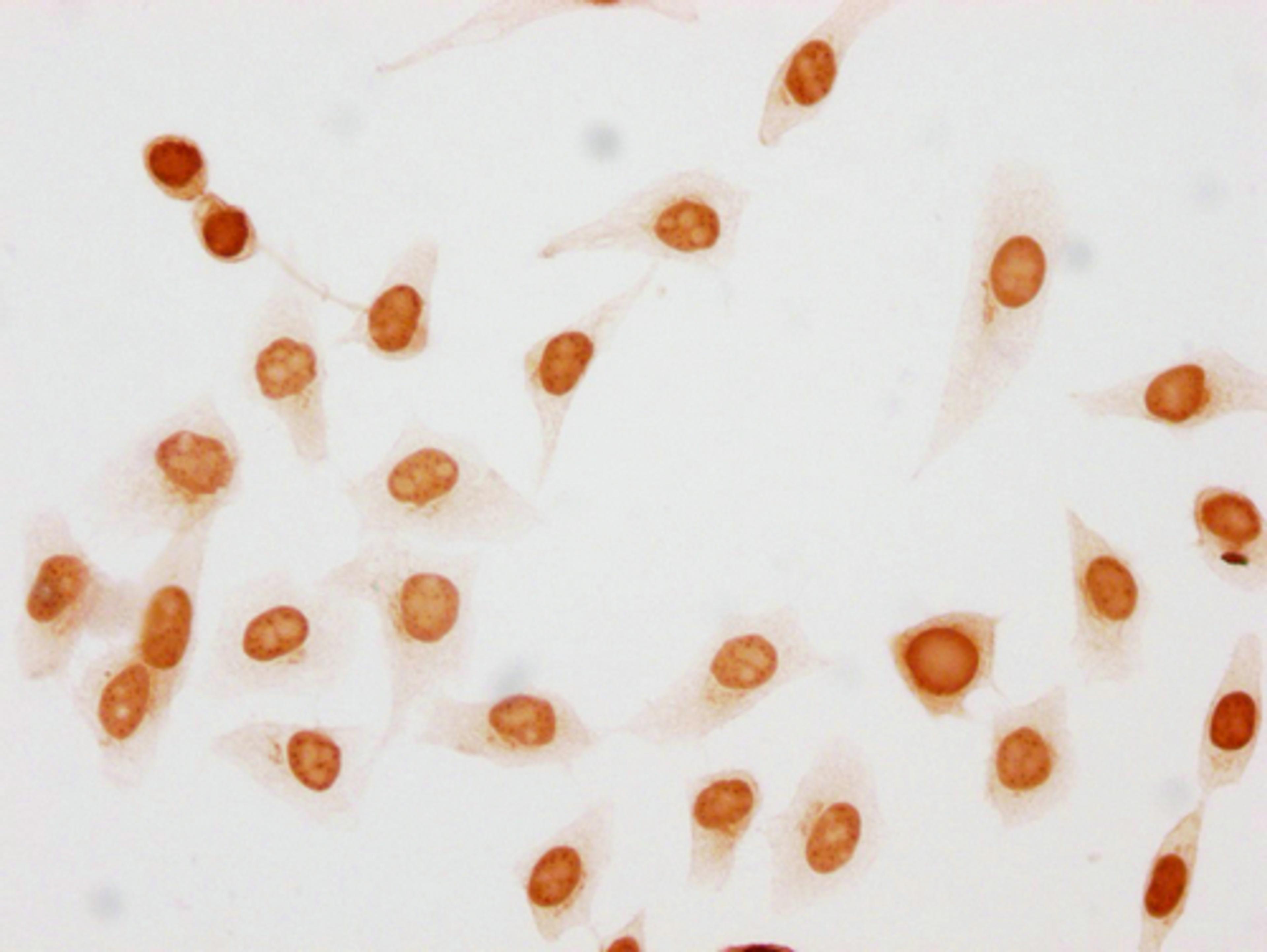 Immunocytochemistry analysis of CSB-PA010377OA10phHU diluted at 1:50 and staining in Hela cells(treated with 50nM Calyculin A for 30min) performed on a Leica BondTM system. The cells were fixed in 4% formaldehyde, permeabilized using 0.2% Triton X-100 and blocked with 10% normal goat serum 30min at RT. Then primary antibody (1% BSA) was incubated at 4°C overnight. The primary is detected by a biotinylated secondary antibody and visualized using an HRP conjugated SP system.