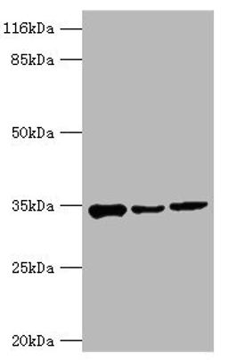 Western blot. All lanes: AQP4 antibody at 2µg/ml. Lane 1: Mouse heart tissue. Lane 2: Mouse brain tissue. Lane 3: Mouse kidney tissue. Secondary. Goat polyclonal to rabbit IgG at 1/10000 dilution. Predicted band size: 35, 33 kDa. Observed band size: 35 kDa