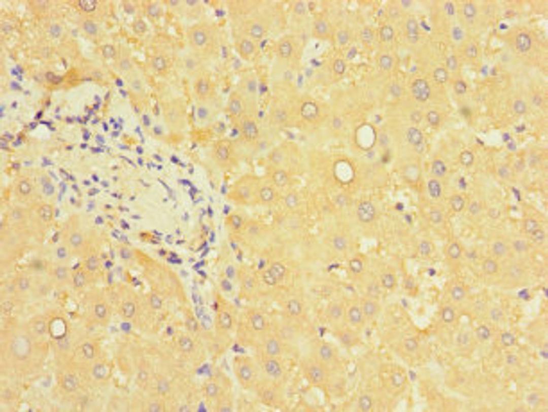 Immunohistochemistry of paraffin-embedded human liver tissue using CSB-PA017514LA01HU at dilution of 1:100
