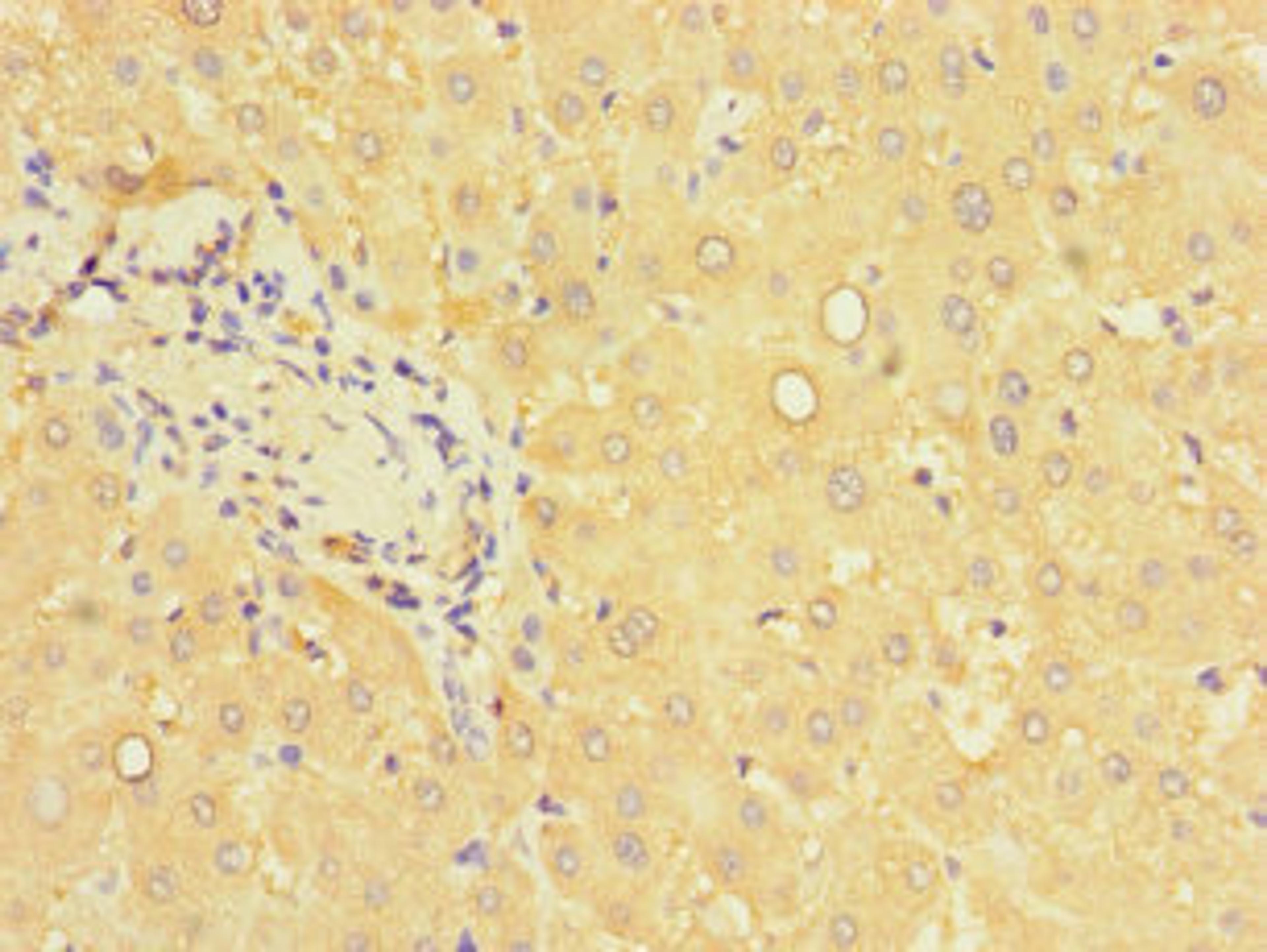 Immunohistochemistry of paraffin-embedded human liver tissue using CSB-PA017514LA01HU at dilution of 1:100