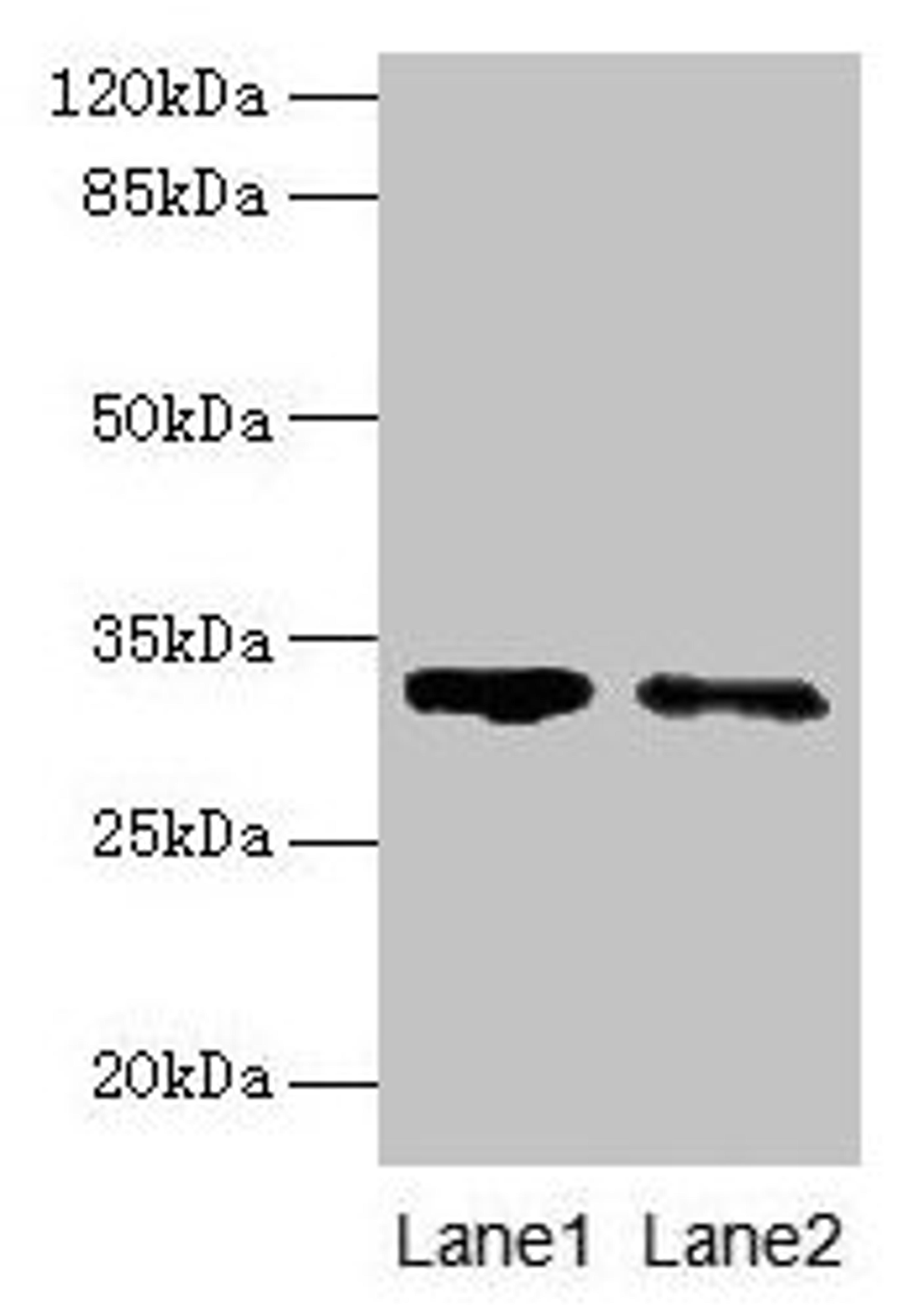 Western blot. All lanes: SLA antibody at 5µg/ml. Lane 1: 293T whole cell lysate. Lane 2: A431 whole cell lysate. Secondary. Goat polyclonal to rabbit IgG at 1/10000 dilution. Predicted band size: 32, 20, 34, 28, 36 kDa. Observed band size: 32 kDa