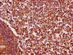 IHC image of CSB-PA005934LA01HU diluted at 1:200 and staining in paraffin-embedded human lymph node tissue performed on a Leica BondTM system. After dewaxing and hydration, antigen retrieval was mediated by high pressure in a citrate buffer (pH 6.0). Section was blocked with 10% normal goat serum 30min at RT. Then primary antibody (1% BSA) was incubated at 4&deg;C overnight. The primary is detected by a biotinylated secondary antibody and visualized using an HRP conjugated SP system.