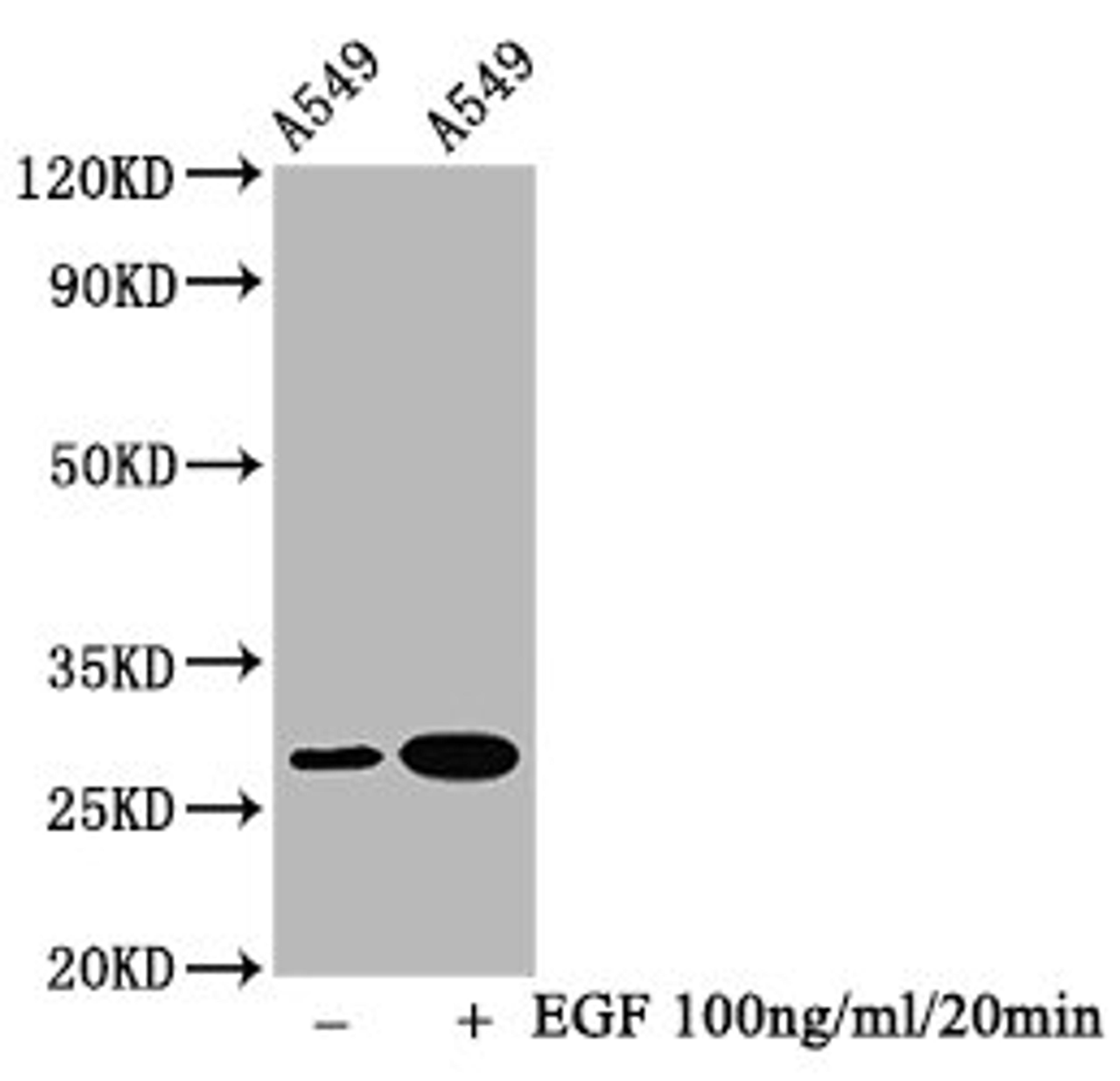 Western Blot. Positive WB detected in A549 whole cell lysate(treated with EGF or not). All lanes Phospho-HSPB1 antibody at 1.5μg/ml. Secondary. Goat polyclonal to rabbit IgG at 1/50000 dilution. Predicted band size: 27 KDa. Observed band size: 27 KDa.