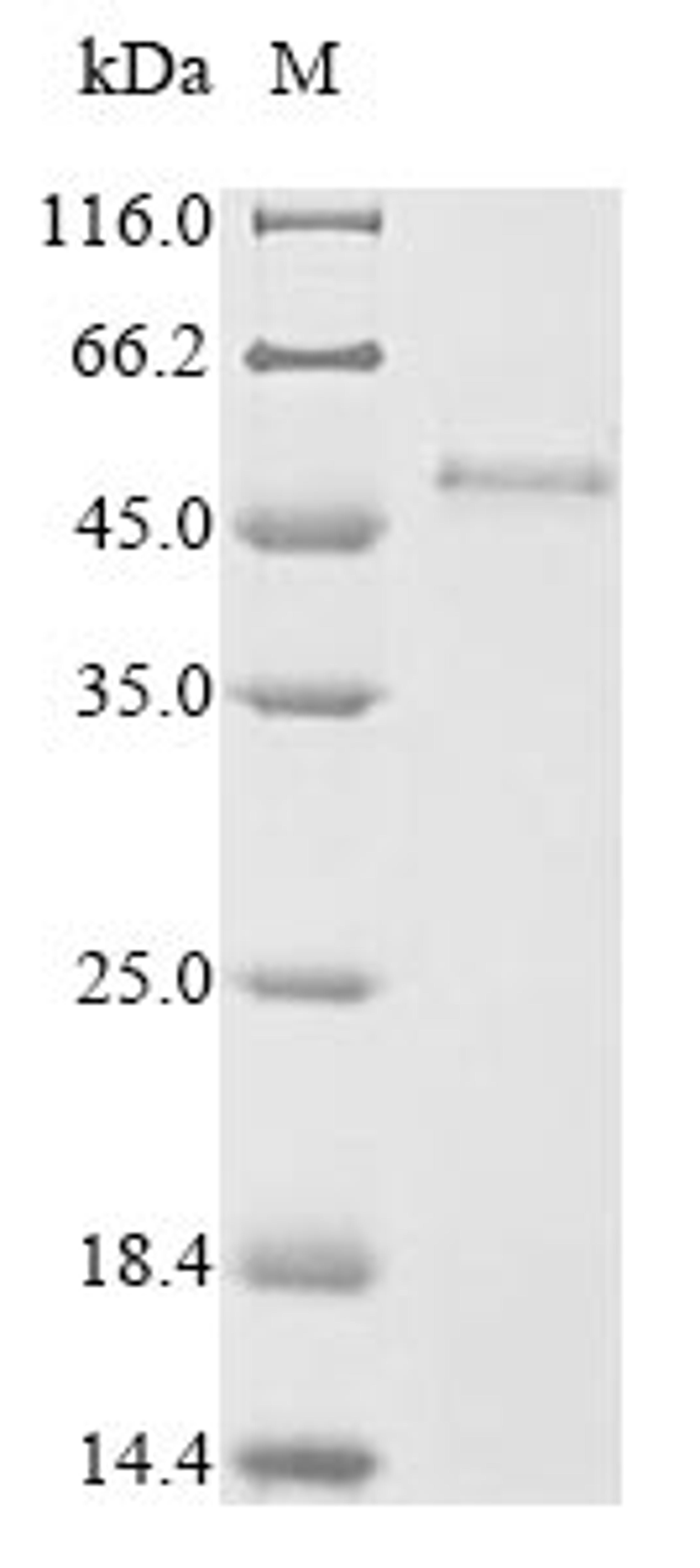 (Tris-Glycine gel) Discontinuous SDS-PAGE (reduced) with 5% enrichment gel and 15% separation gel.