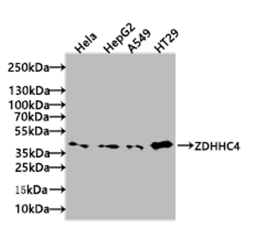 Western blot. All lanes: ZDHHC4 antibody at 1.5µg/ml + Mouse liver tissue. Secondary. Goat polyclonal to rabbit IgG at 1/10000 dilution. Predicted band size: 40 kDa. Observed band size: 40 kDa