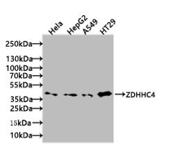 Western blot. All lanes: ZDHHC4 antibody at 1.5µg/ml + Mouse liver tissue. Secondary. Goat polyclonal to rabbit IgG at 1/10000 dilution. Predicted band size: 40 kDa. Observed band size: 40 kDa