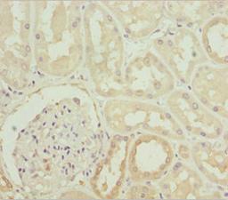 Immunohistochemistry of paraffin-embedded human kidney tissue using CSB-PA866264ESR1HU at dilution of 1:100