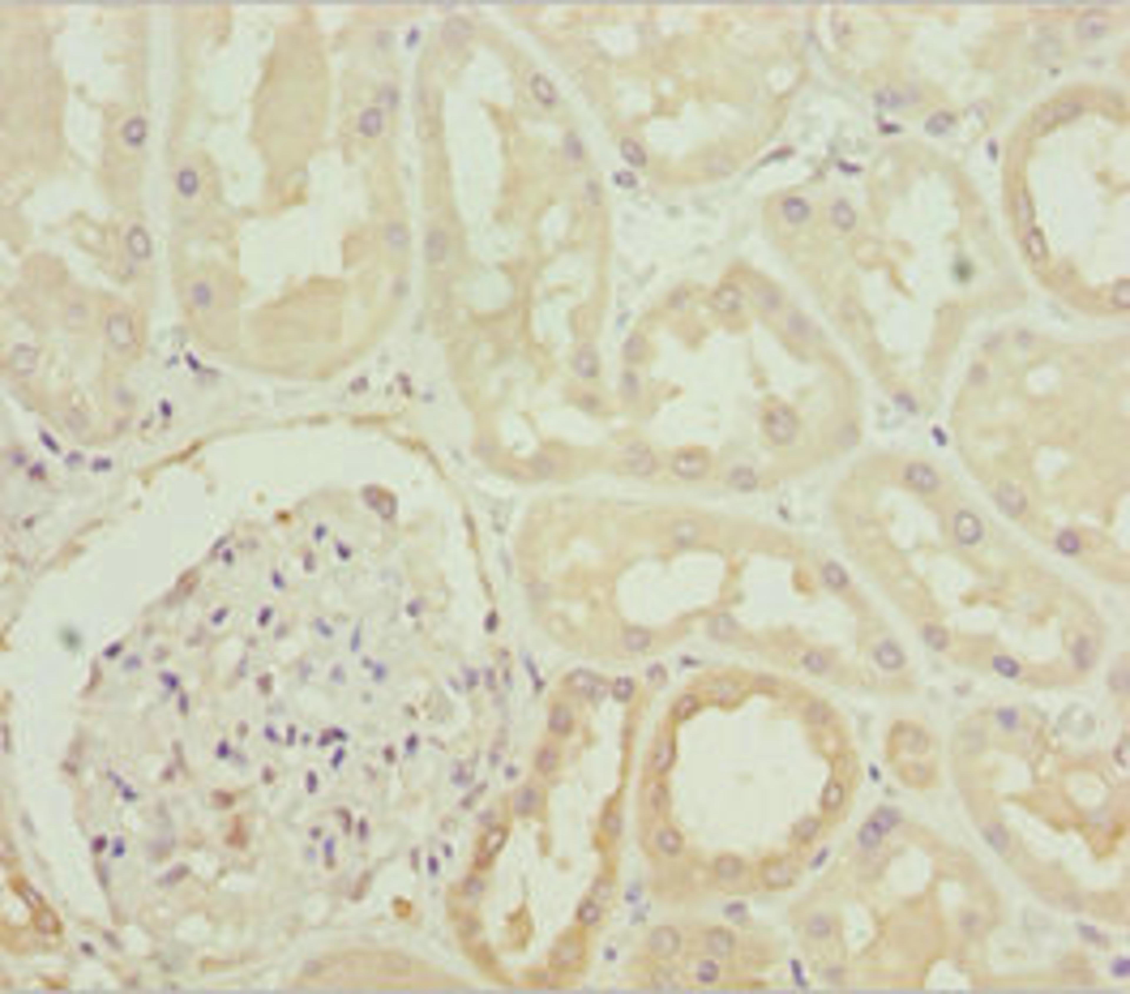 Immunohistochemistry of paraffin-embedded human kidney tissue using CSB-PA866264ESR1HU at dilution of 1:100