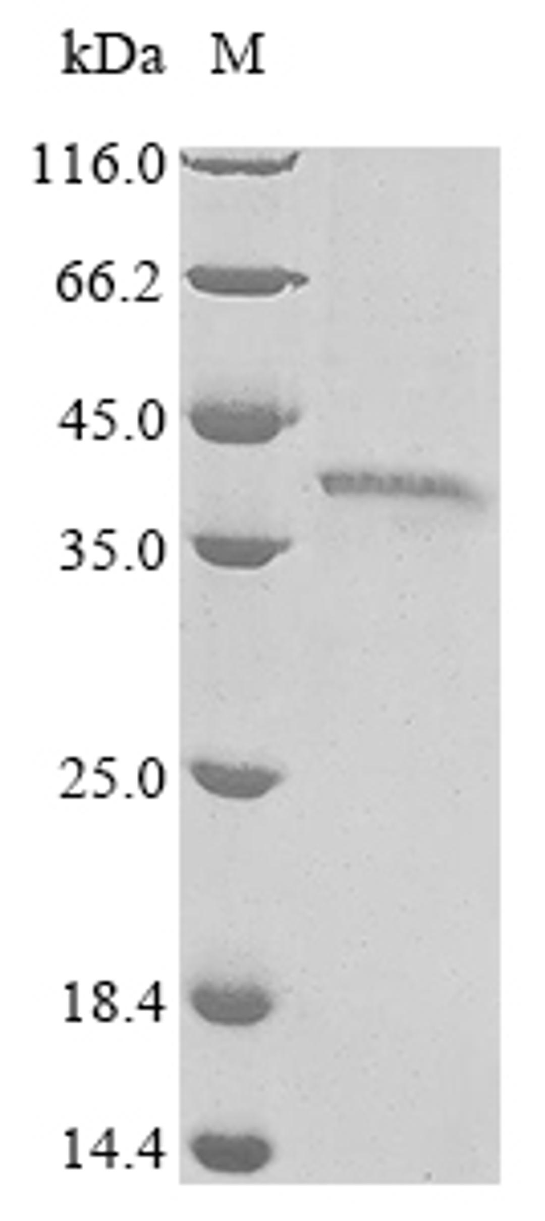 (Tris-Glycine gel) Discontinuous SDS-PAGE (reduced) with 5% enrichment gel and 15% separation gel.