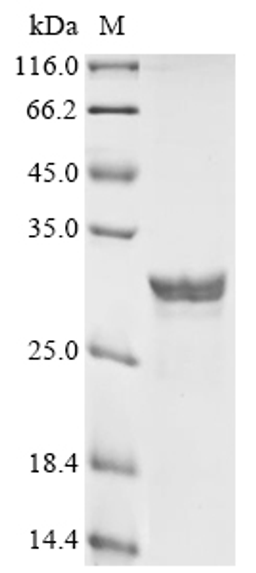 (Tris-Glycine gel) Discontinuous SDS-PAGE (reduced) with 5% enrichment gel and 15% separation gel.
