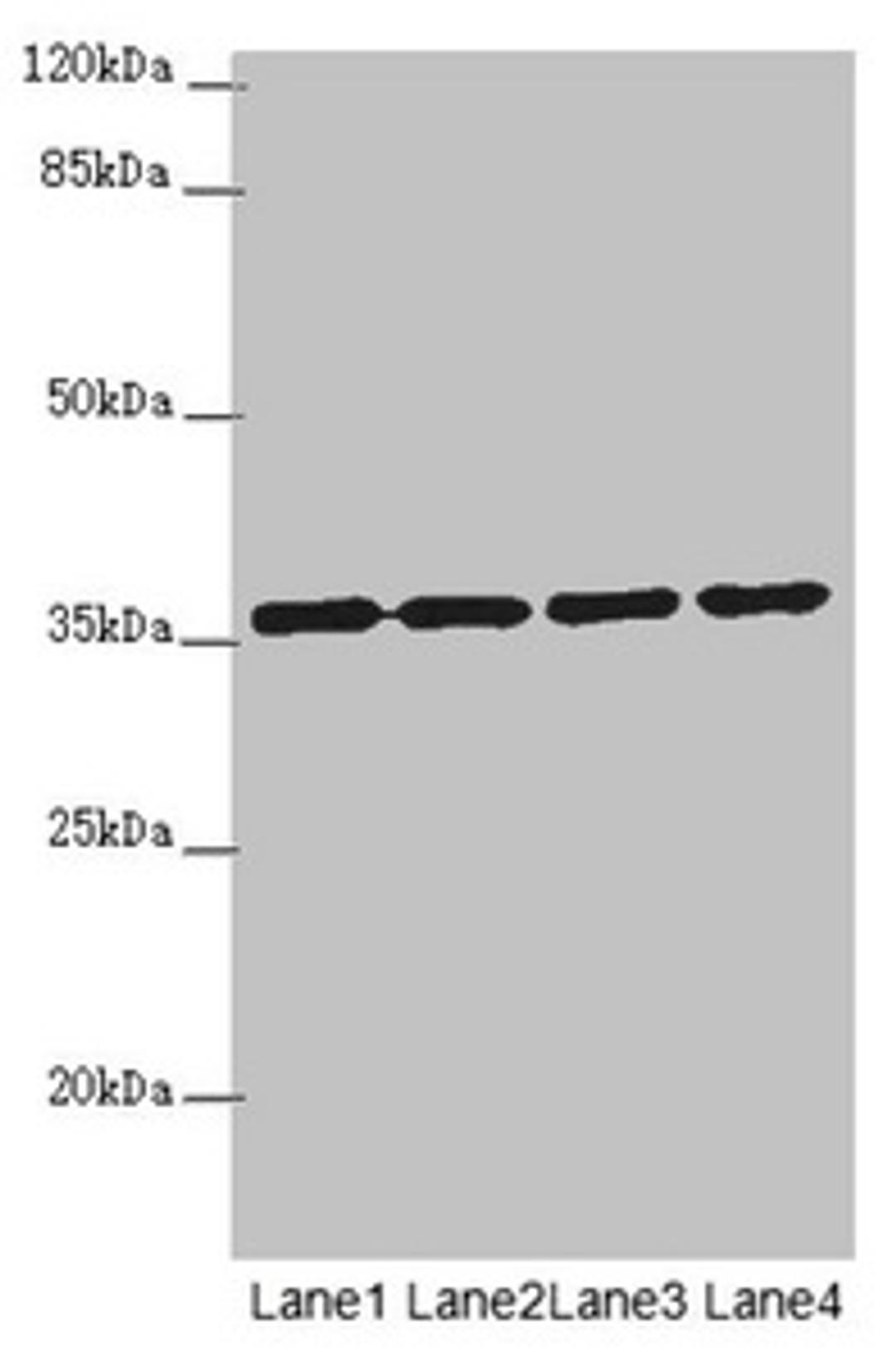 Western blot. All lanes: OSGEP antibody at 3.18µg/ml. Lane 1: 293T whole cell lysate. Lane 2: Jurkat whole cell lysate. Lane 3: Raji whole cell lysate. Lane 4: PC-3 whole cell lysate. Secondary. Goat polyclonal to rabbit IgG at 1/10000 dilution. Predicted band size: 36 kDa. Observed band size: 36 kDa