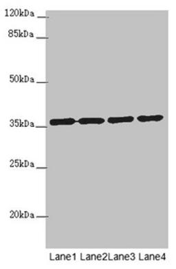 Western blot. All lanes: OSGEP antibody at 3.18µg/ml. Lane 1: 293T whole cell lysate. Lane 2: Jurkat whole cell lysate. Lane 3: Raji whole cell lysate. Lane 4: PC-3 whole cell lysate. Secondary. Goat polyclonal to rabbit IgG at 1/10000 dilution. Predicted band size: 36 kDa. Observed band size: 36 kDa
