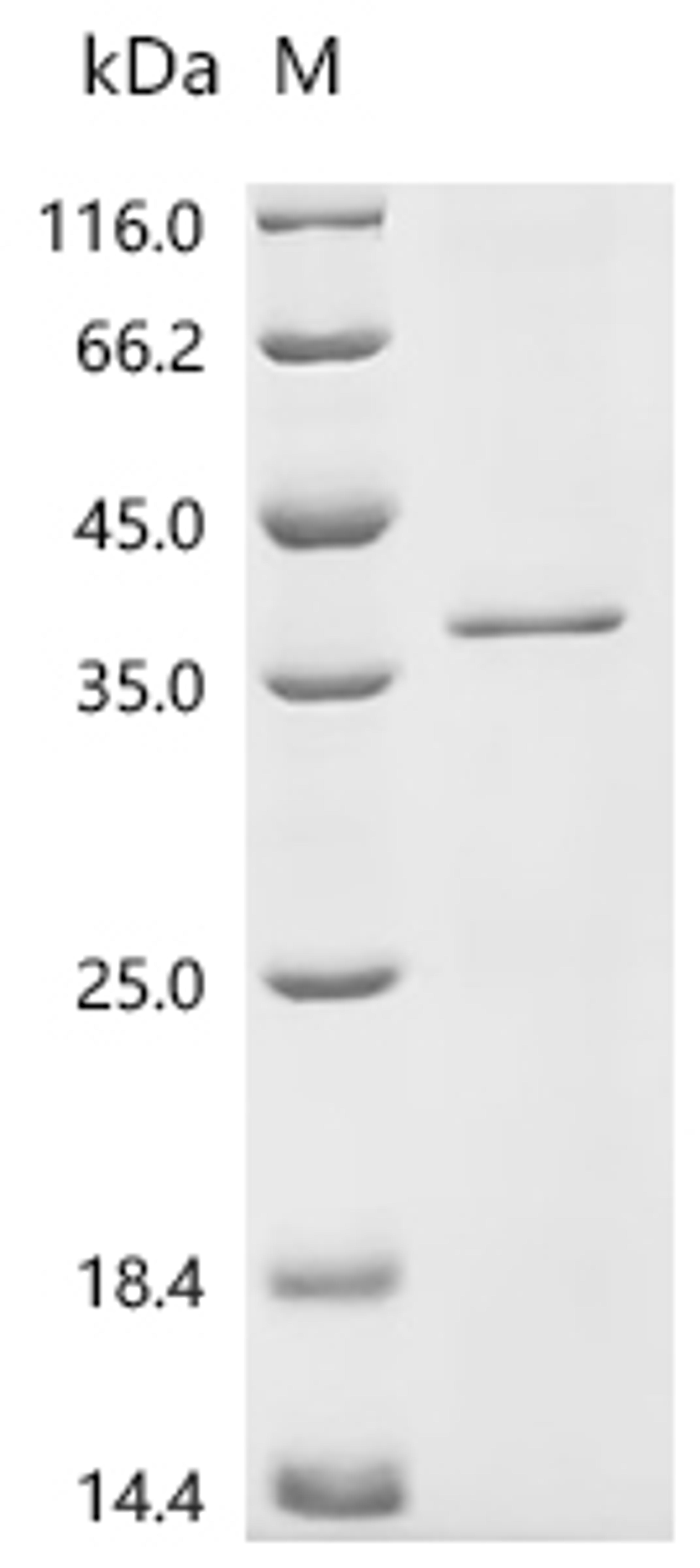 (Tris-Glycine gel) Discontinuous SDS-PAGE (reduced) with 5% enrichment gel and 15% separation gel.