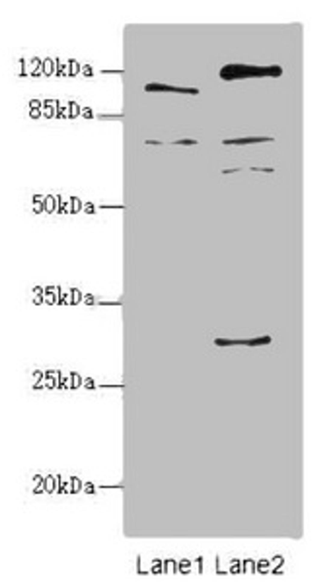 Western blot. All lanes: TM9SF1 antibody at 2.18ug/ml. Lane 1: Mouse liver tissue. Lane 2: Mouse kidney tissue. Secondary. Goat polyclonal to rabbit IgG at 1/10000 dilution. Predicted band size: 69, 56 kDa. Observed band size: 69, 110, 59, 28 kDa. 