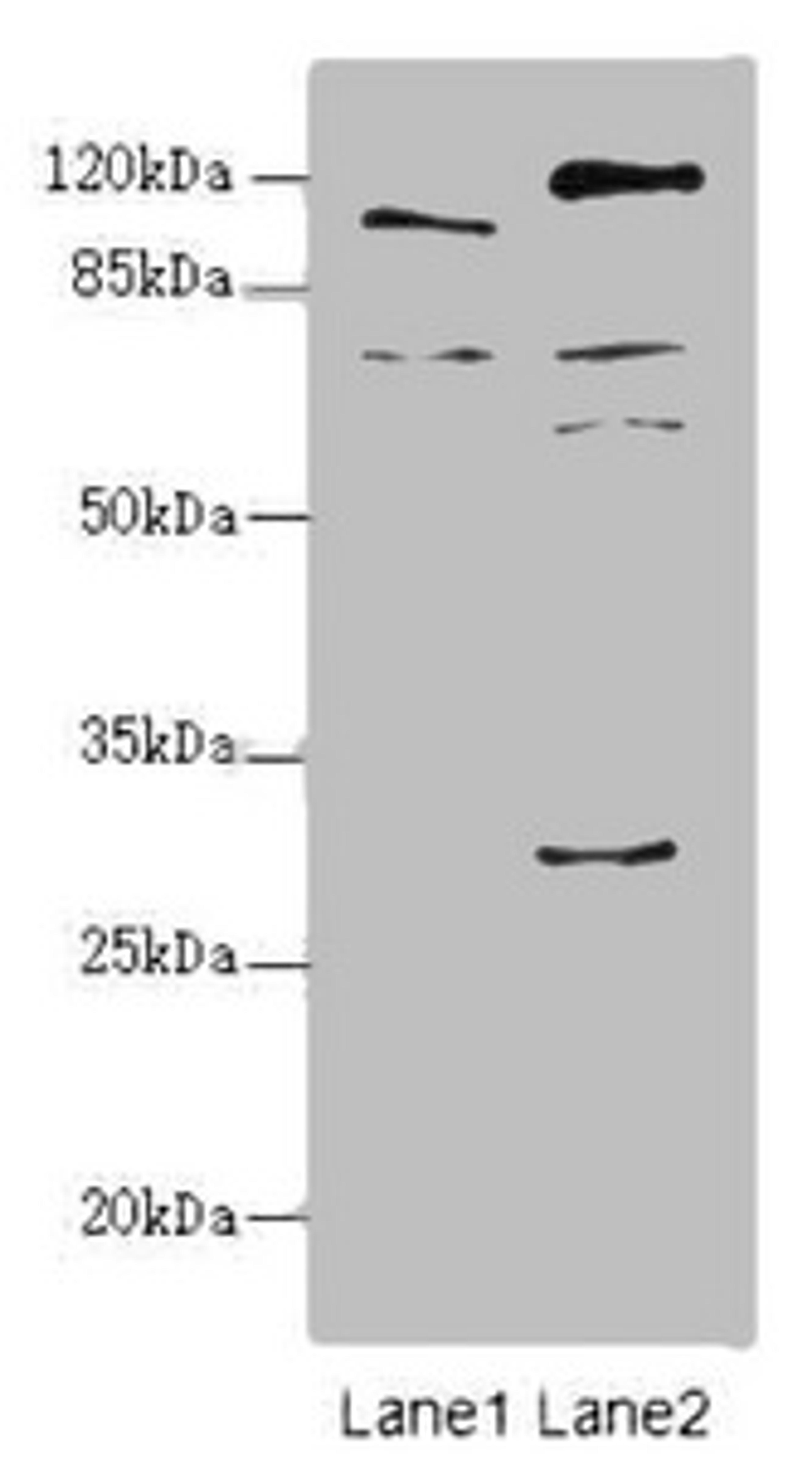 Western blot. All lanes: TM9SF1 antibody at 2.18ug/ml. Lane 1: Mouse liver tissue. Lane 2: Mouse kidney tissue. Secondary. Goat polyclonal to rabbit IgG at 1/10000 dilution. Predicted band size: 69, 56 kDa. Observed band size: 69, 110, 59, 28 kDa. 