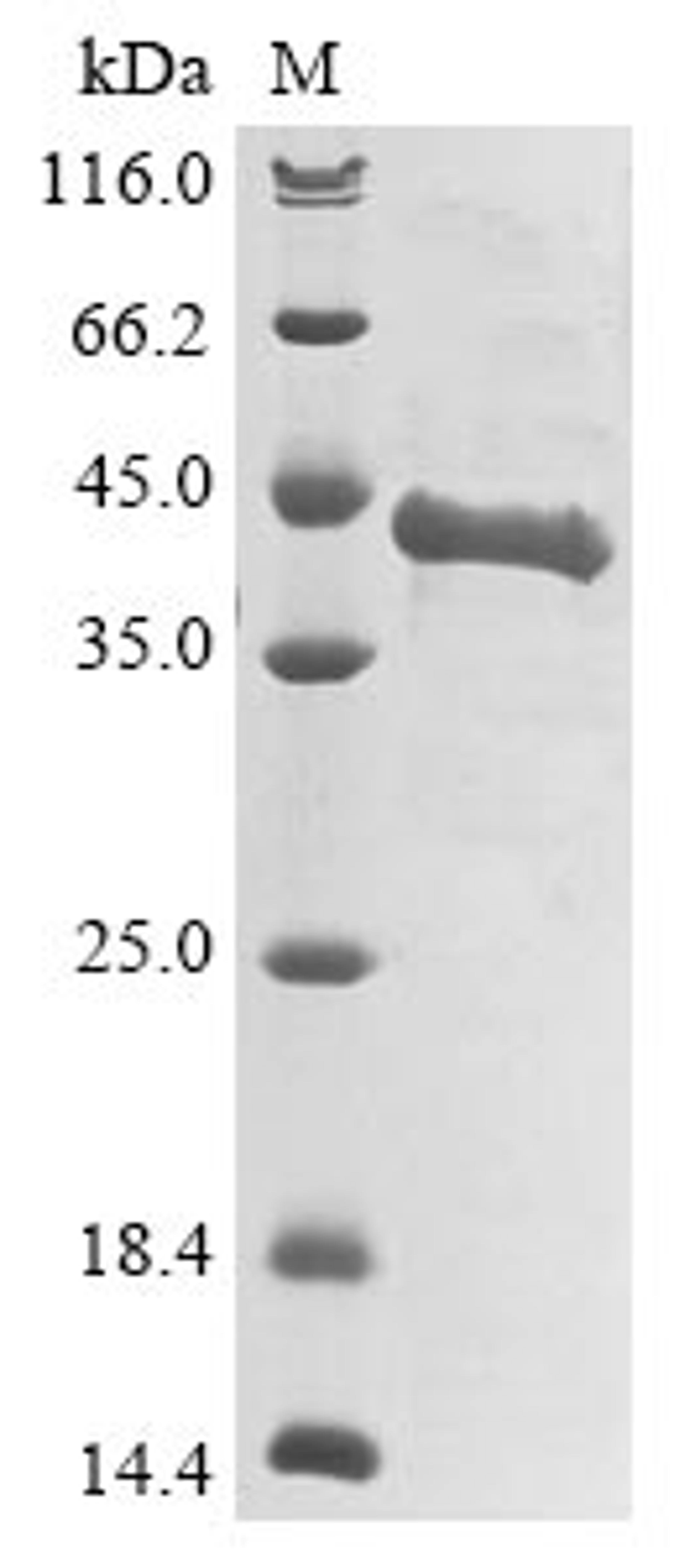 (Tris-Glycine gel) Discontinuous SDS-PAGE (reduced) with 5% enrichment gel and 15% separation gel.