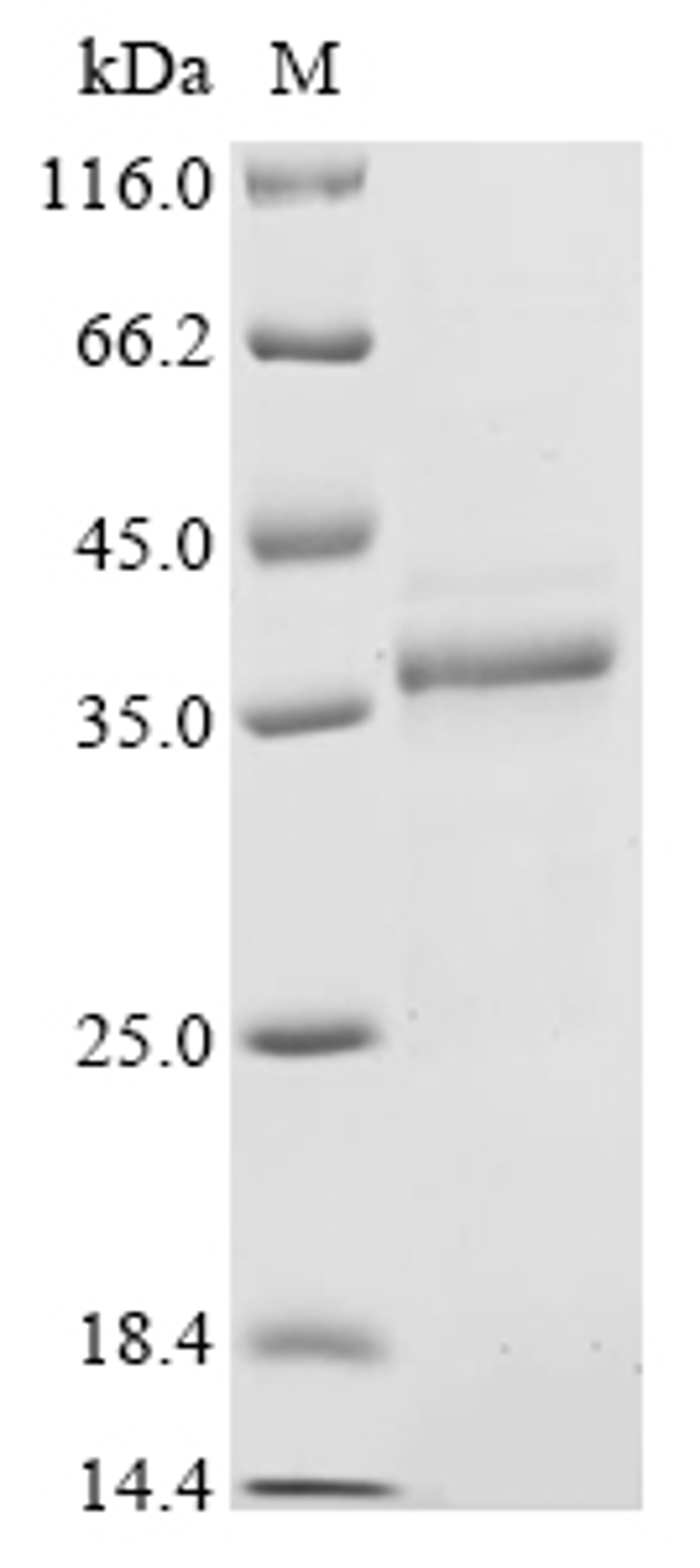 (Tris-Glycine gel) Discontinuous SDS-PAGE (reduced) with 5% enrichment gel and 15% separation gel.