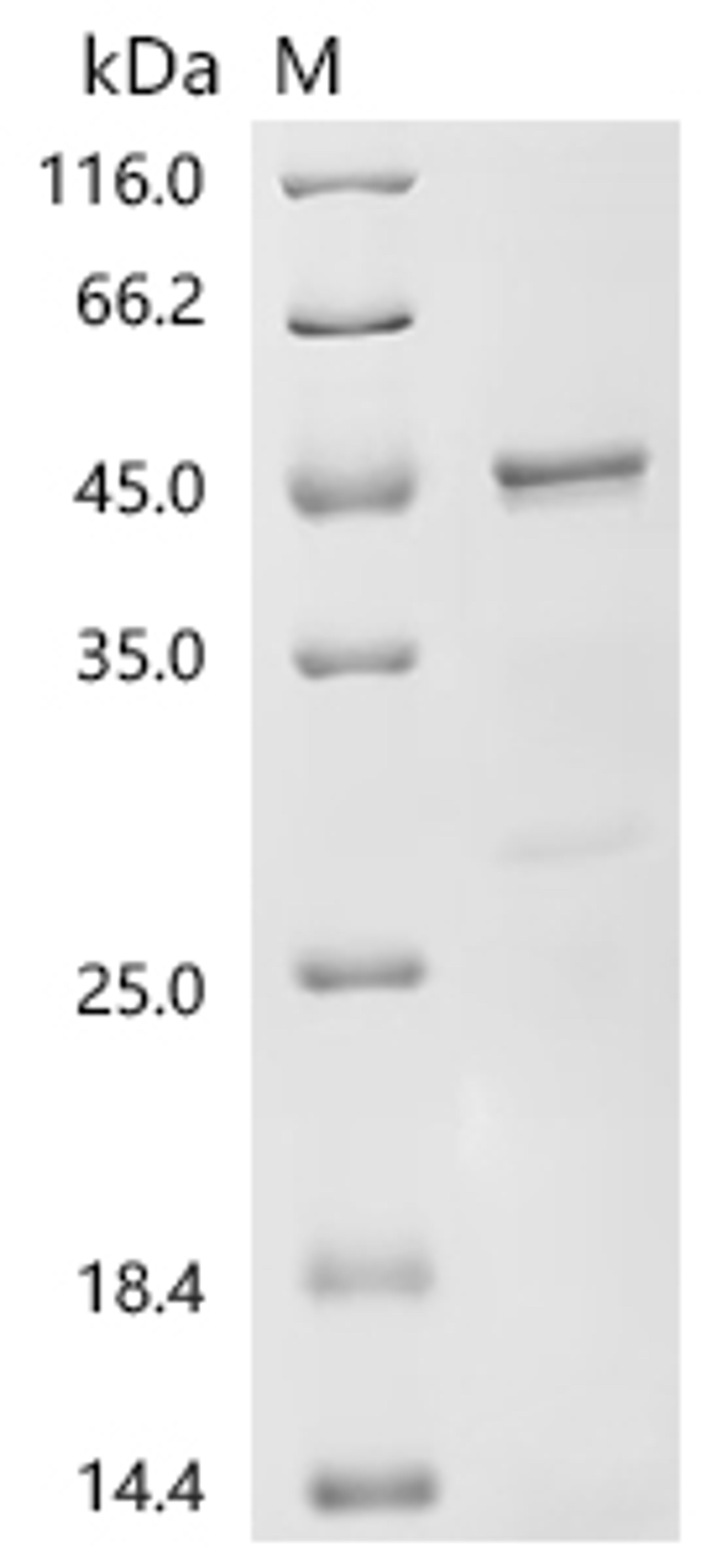 (Tris-Glycine gel) Discontinuous SDS-PAGE (reduced) with 5% enrichment gel and 15% separation gel.