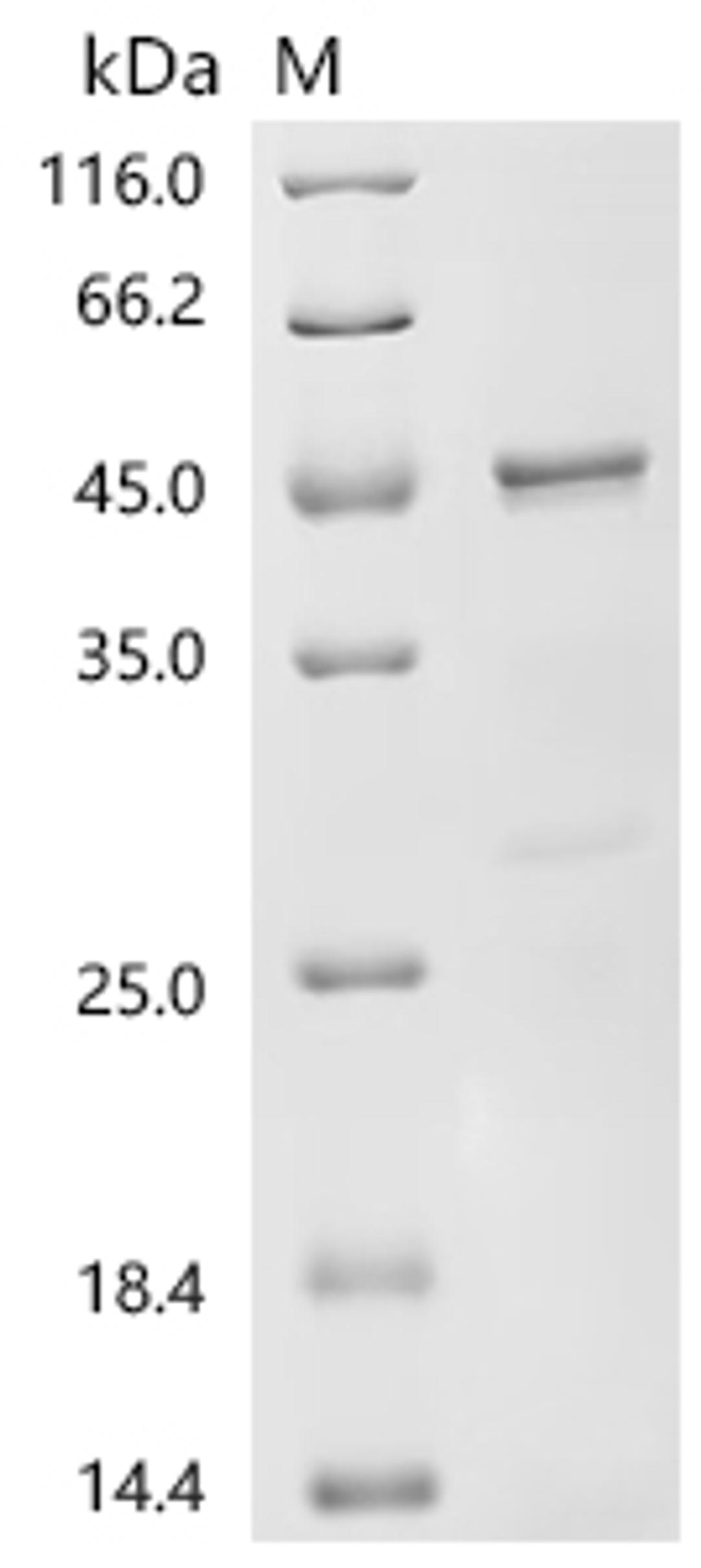 (Tris-Glycine gel) Discontinuous SDS-PAGE (reduced) with 5% enrichment gel and 15% separation gel.