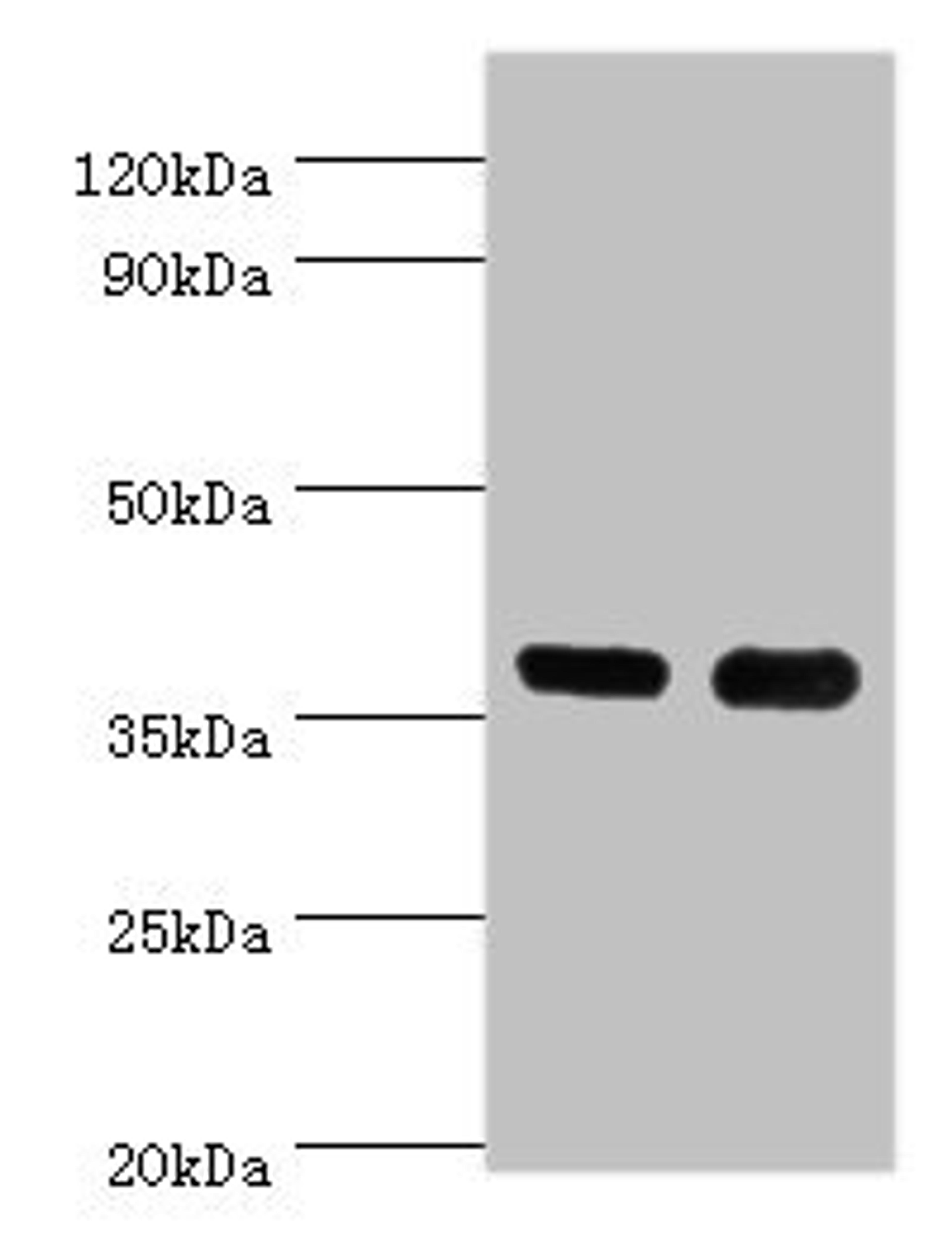 Western blot. All lanes: CD1A antibody at 6ug/ml. Lane 1: K562 whole cell lysate. Lane 2: Mouse thymus tissue. Secondary. Goat polyclonal to rabbit IgG at 1/10000 dilution. Predicted band size: 37 kDa. Observed band size: 37 kDa.