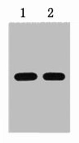 1ug HSV fusion protein+ Primary antibody dilution at  1) 1:5000 2) 1:10000