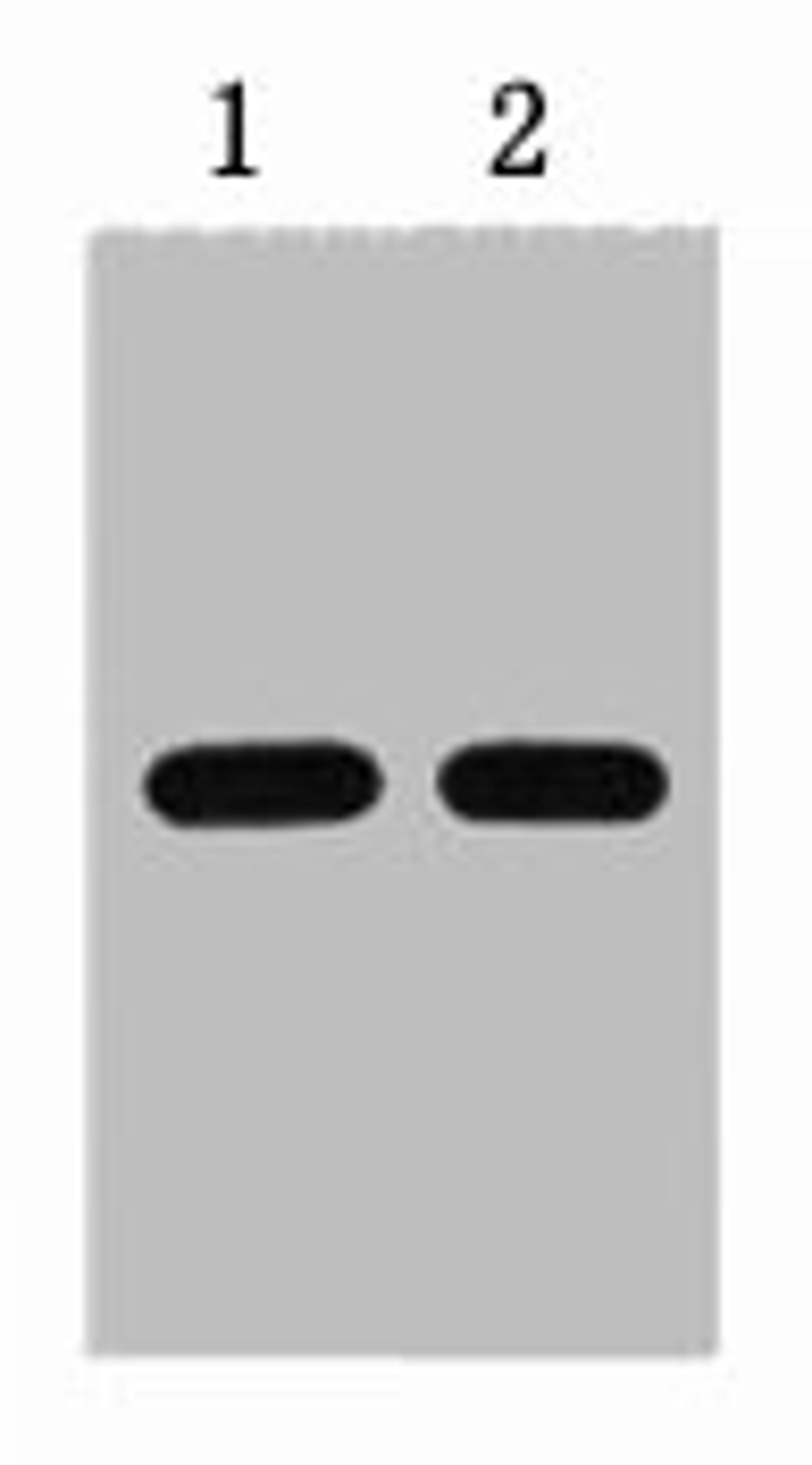 1ug HSV fusion protein+ Primary antibody dilution at  1) 1:5000 2) 1:10000