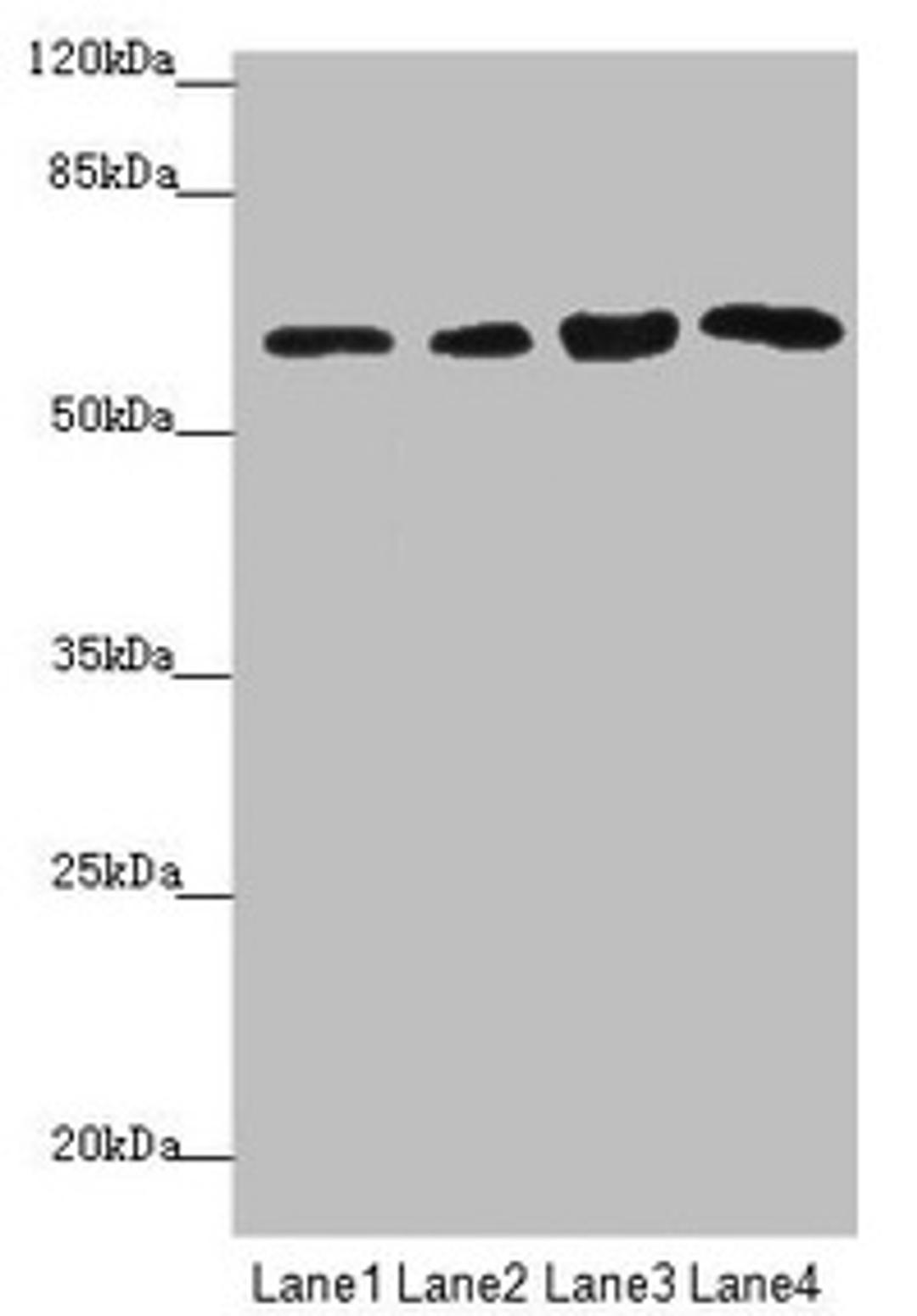 Western blot. All lanes: FBXO7 antibody at 3.97µg/ml. Lane 1: Mouse gonadal tissue. Lane 2: Jurkat whole cell lysate. Lane 3: 293T whole cell lysate. Lane 4: PC-3 whole cell lysate. Secondary. Goat polyclonal to rabbit IgG at 1/10000 dilution. Predicted band size: 59, 50, 46 kDa. Observed band size: 59 kDa