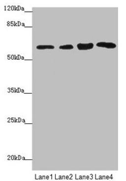 Western blot. All lanes: FBXO7 antibody at 3.97µg/ml. Lane 1: Mouse gonadal tissue. Lane 2: Jurkat whole cell lysate. Lane 3: 293T whole cell lysate. Lane 4: PC-3 whole cell lysate. Secondary. Goat polyclonal to rabbit IgG at 1/10000 dilution. Predicted band size: 59, 50, 46 kDa. Observed band size: 59 kDa